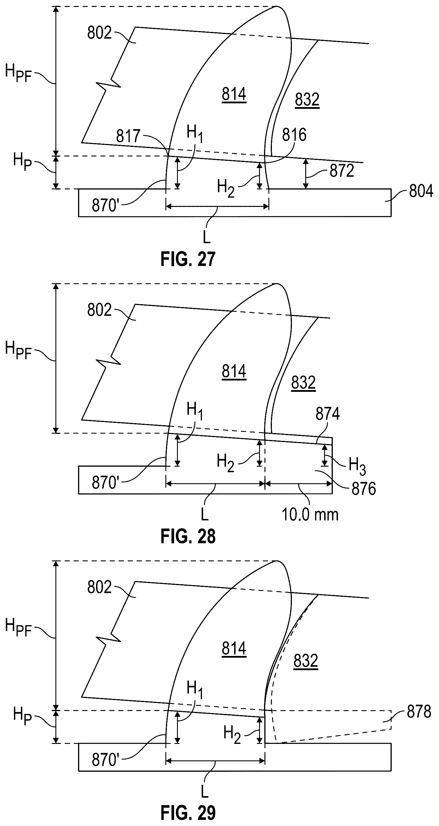 Patent US12318325 Figure 17 – Maxillary and mandibular devices that prevent disengagement therebetween, controller station, and methods of treating and/or diagnosing medical disorders