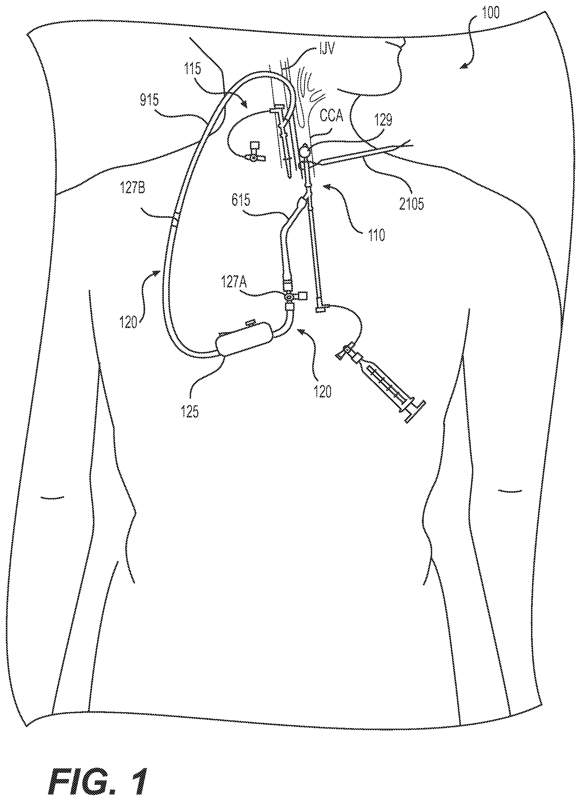 Patent US12318327 — Systems and methods for treating eye diseases — Figure 1
