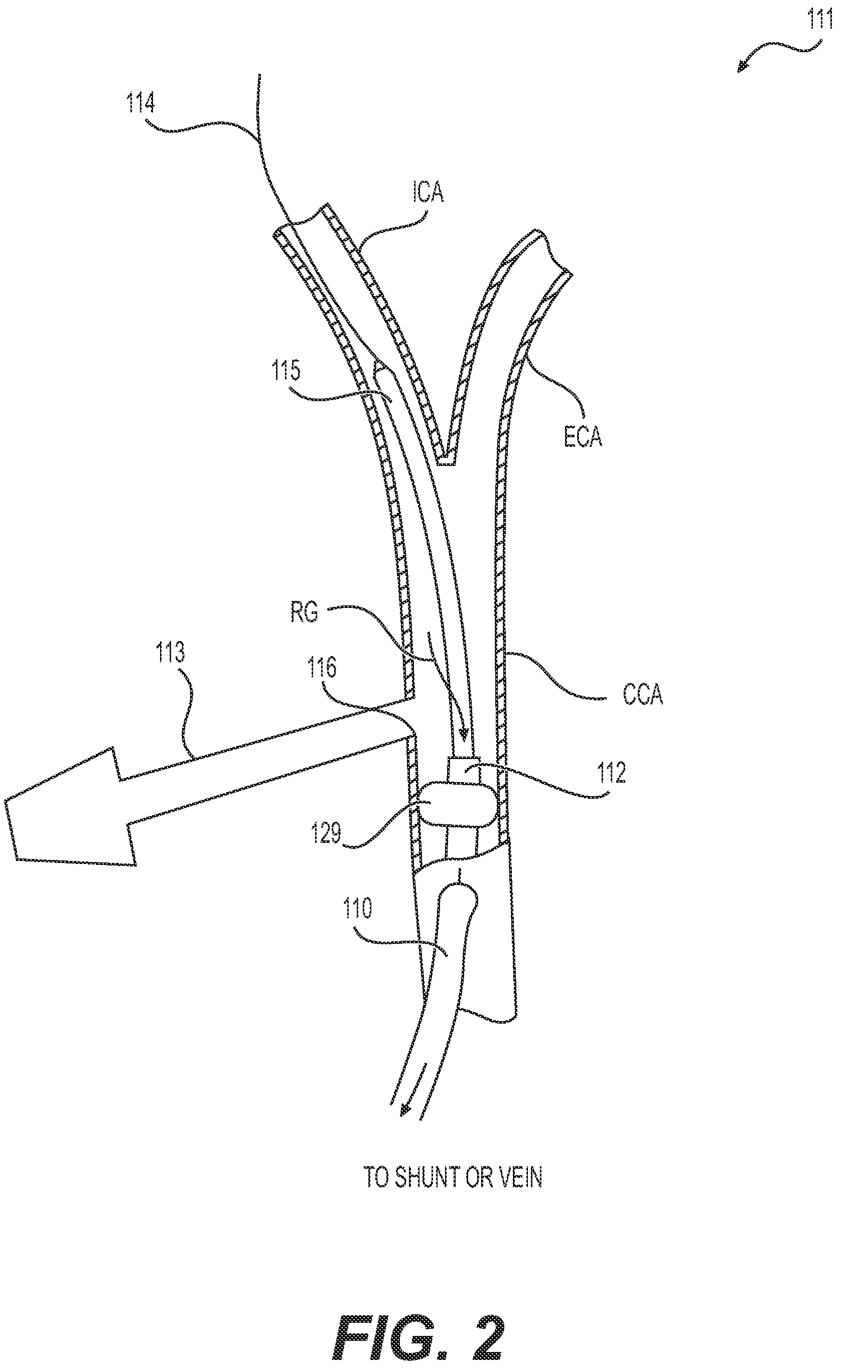 Patent US12318327 Figure 2 – Systems and methods for treating eye diseases