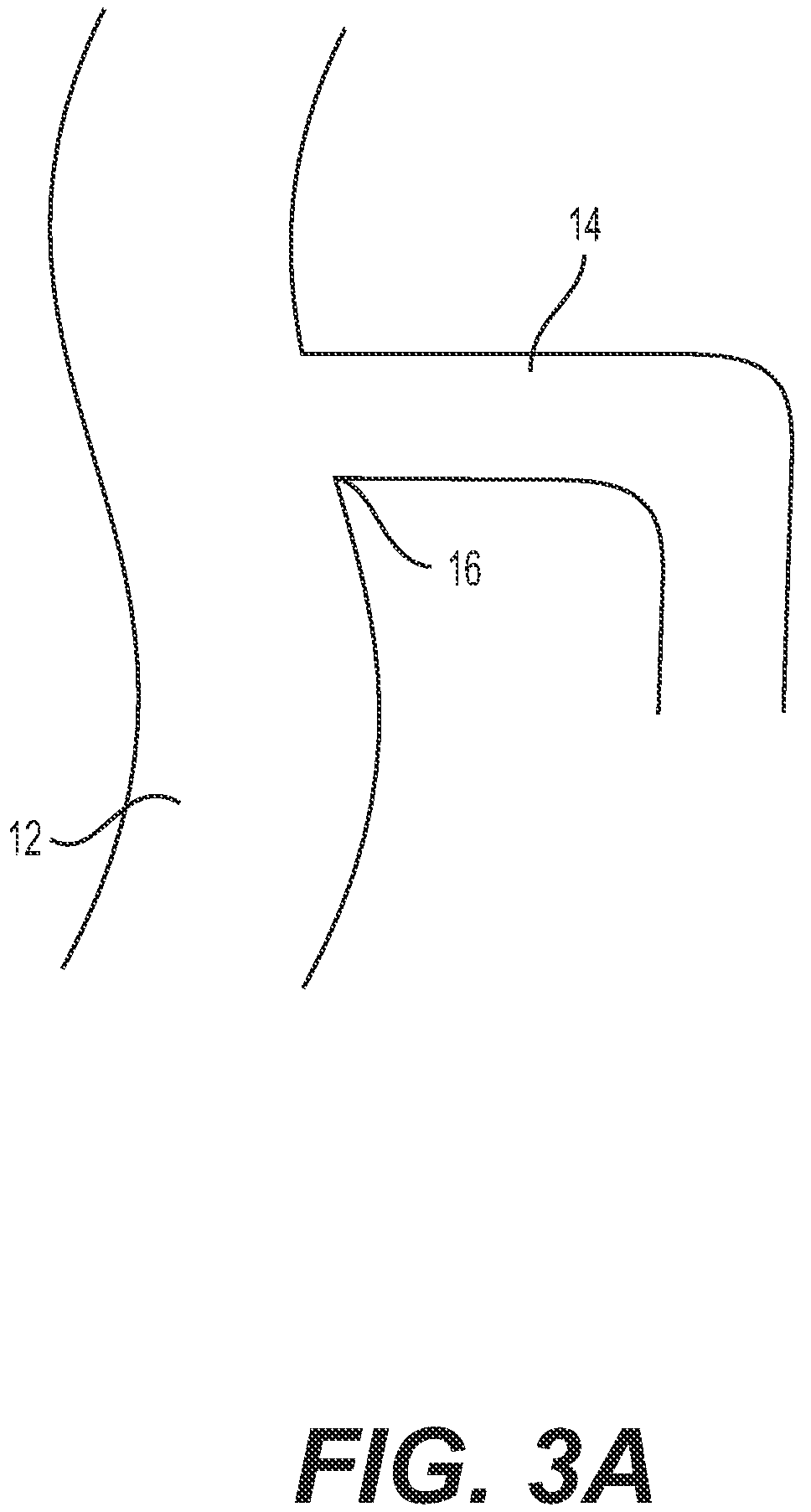 Patent US12318327 Figure 3 – Systems and methods for treating eye diseases