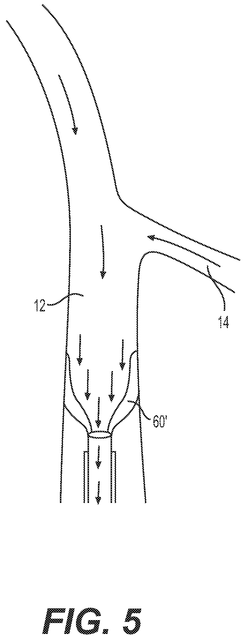 Patent US12318327 Figure 6 – Systems and methods for treating eye diseases