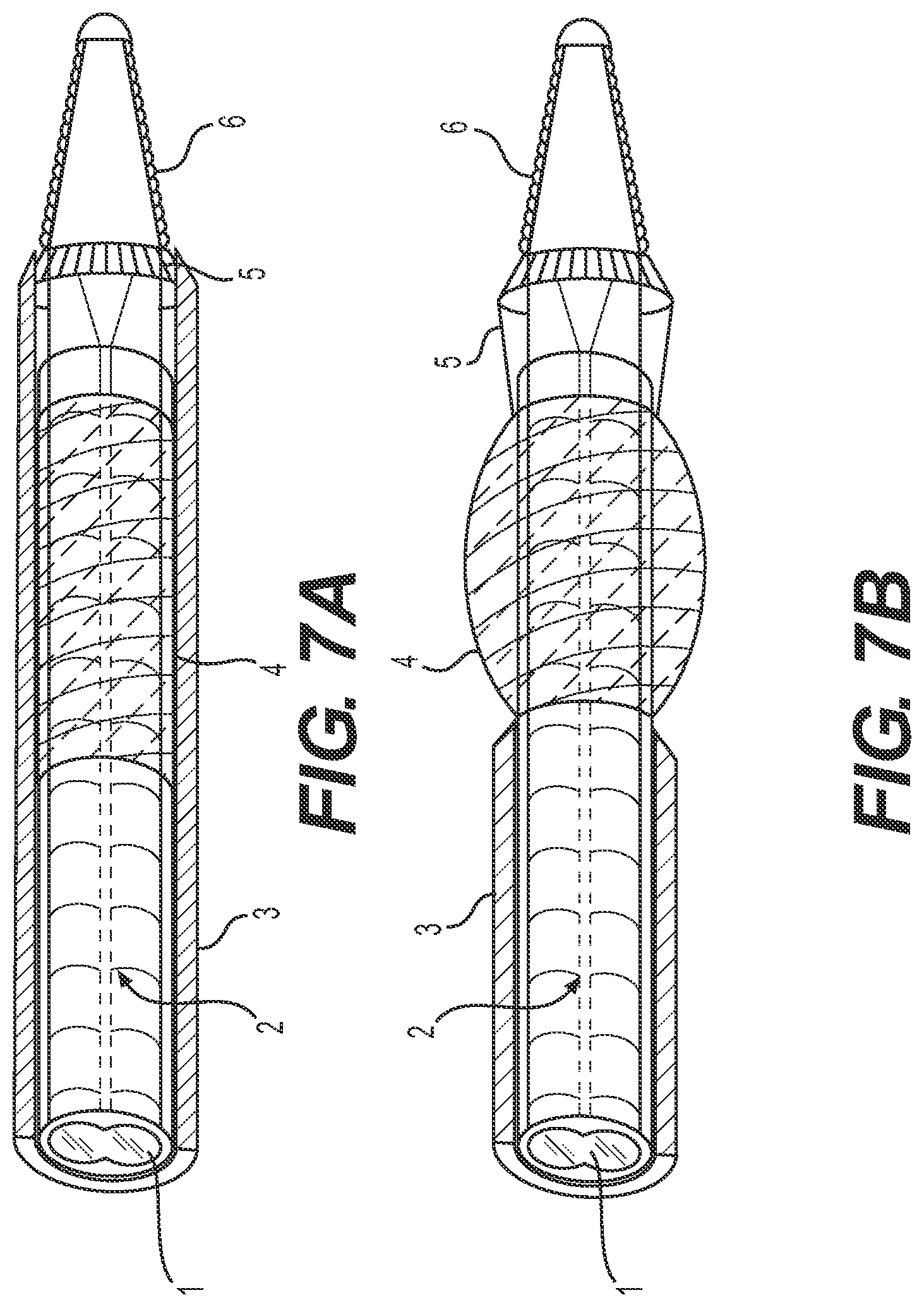 Patent US12318327 Figure 8 – Systems and methods for treating eye diseases