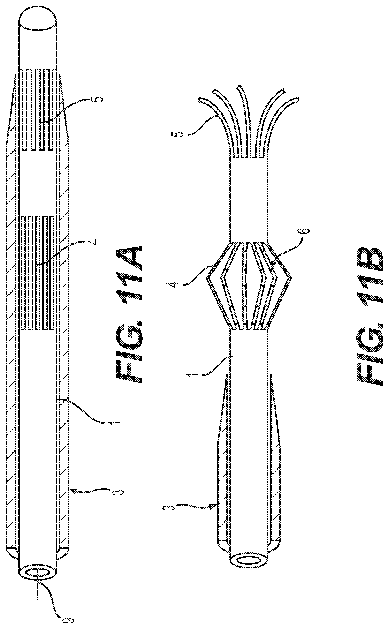 Patent US12318327 Figure 12 – Systems and methods for treating eye diseases