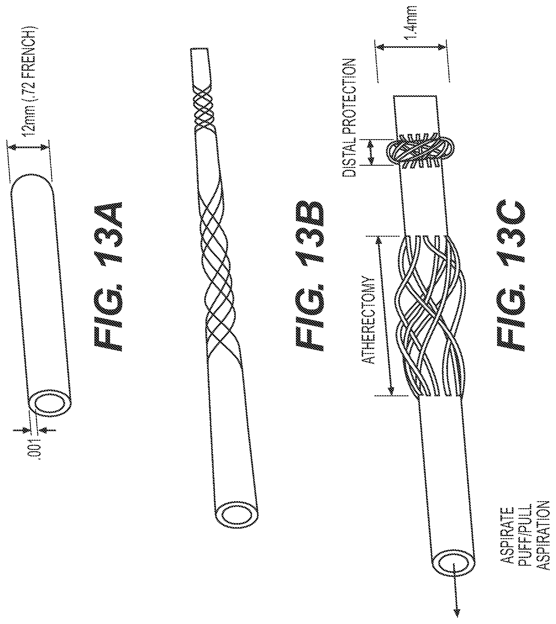 Patent US12318327 Figure 15 – Systems and methods for treating eye diseases