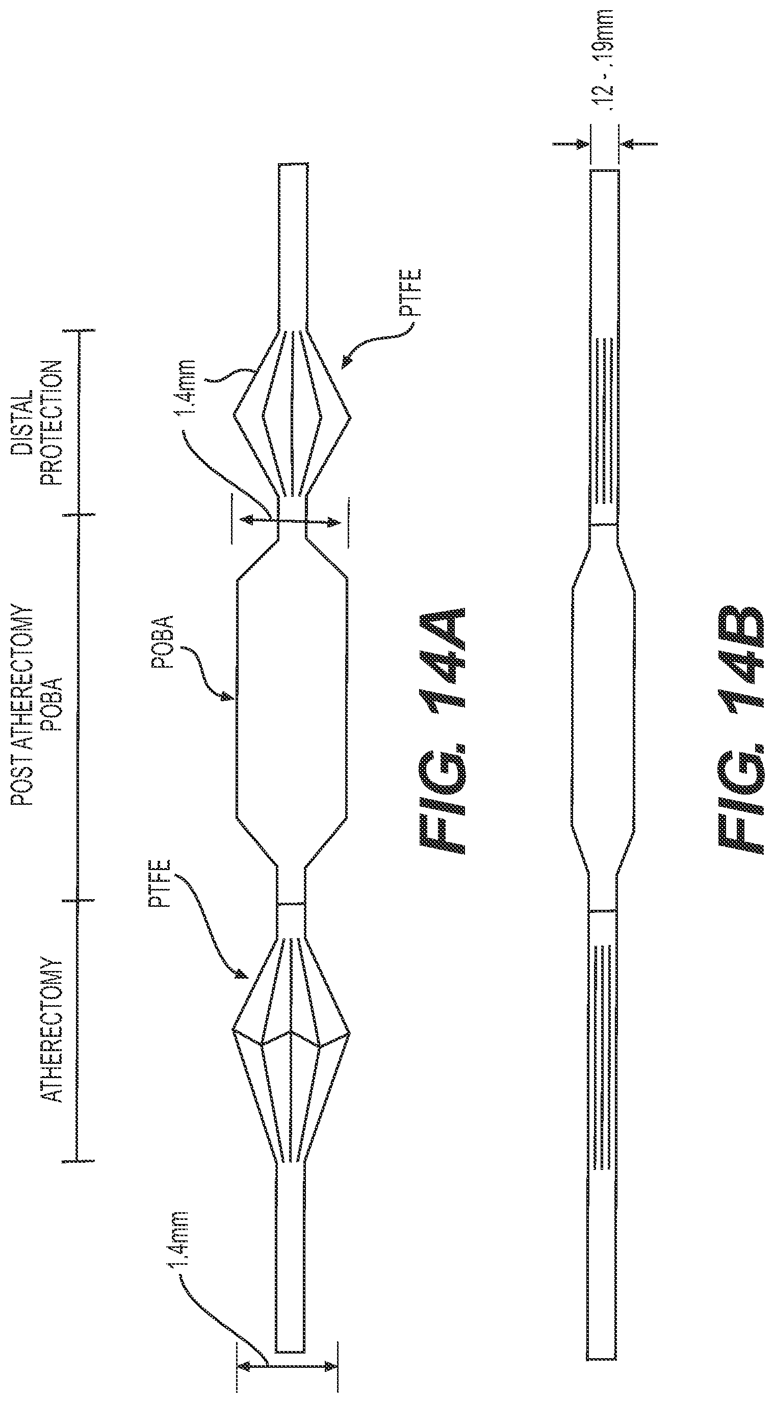 Patent US12318327 Figure 16 – Systems and methods for treating eye diseases