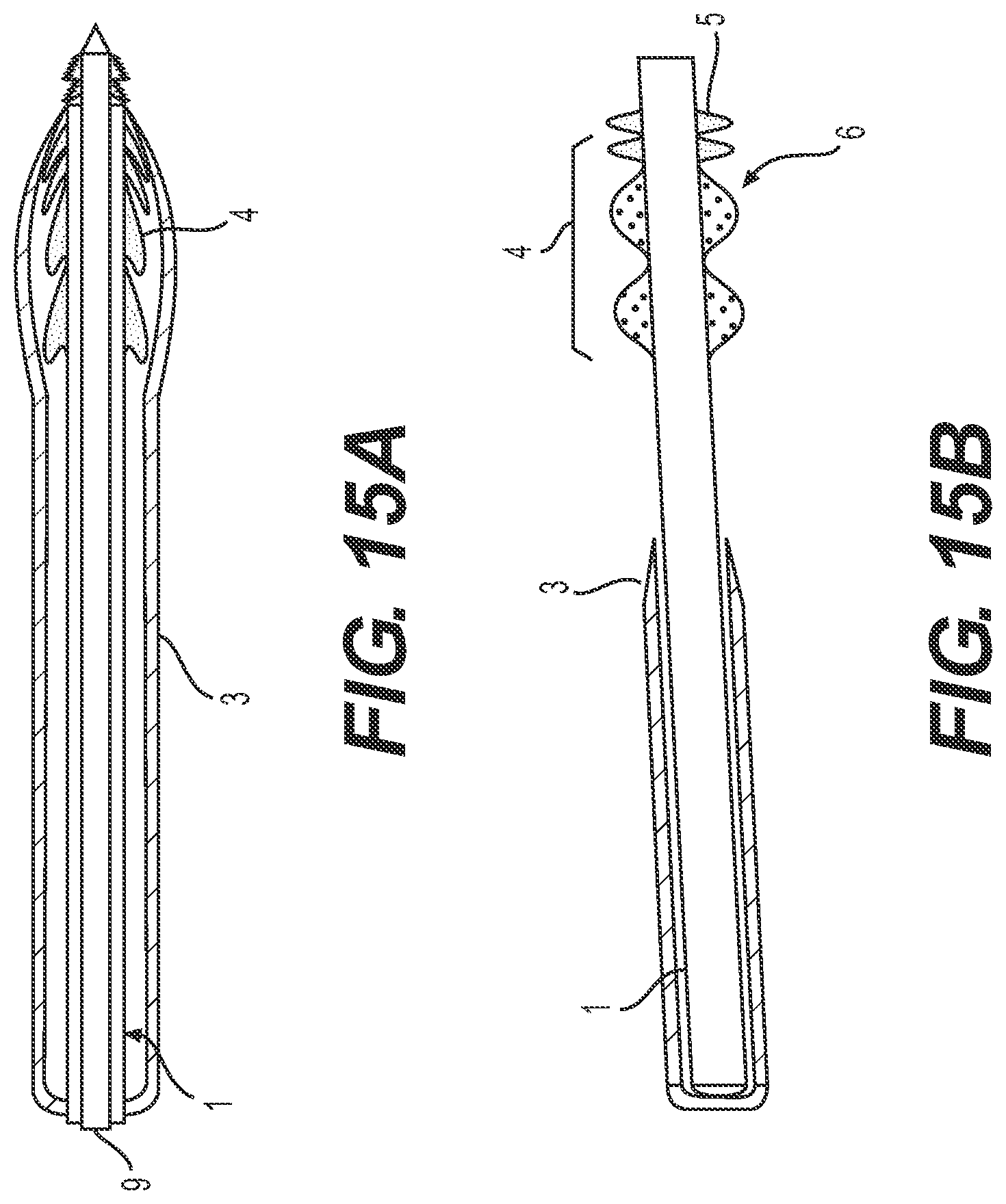 Patent US12318327 Figure 17 – Systems and methods for treating eye diseases