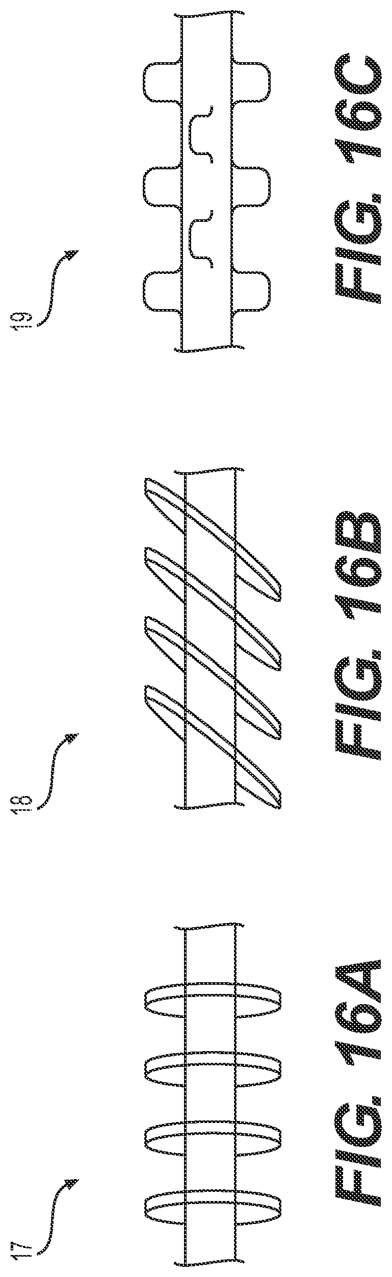 Patent US12318327 Figure 18 – Systems and methods for treating eye diseases
