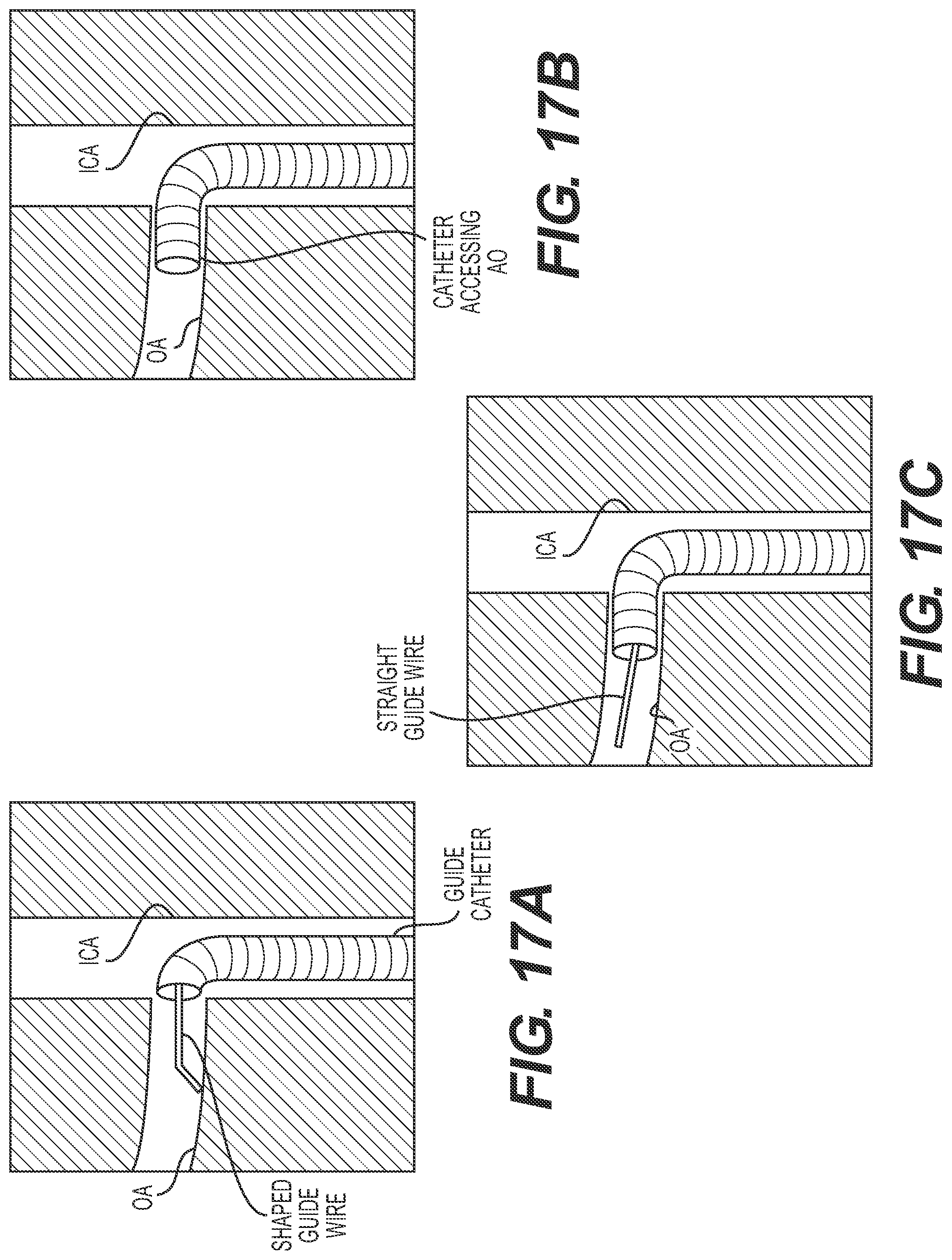 Patent US12318327 Figure 19 – Systems and methods for treating eye diseases