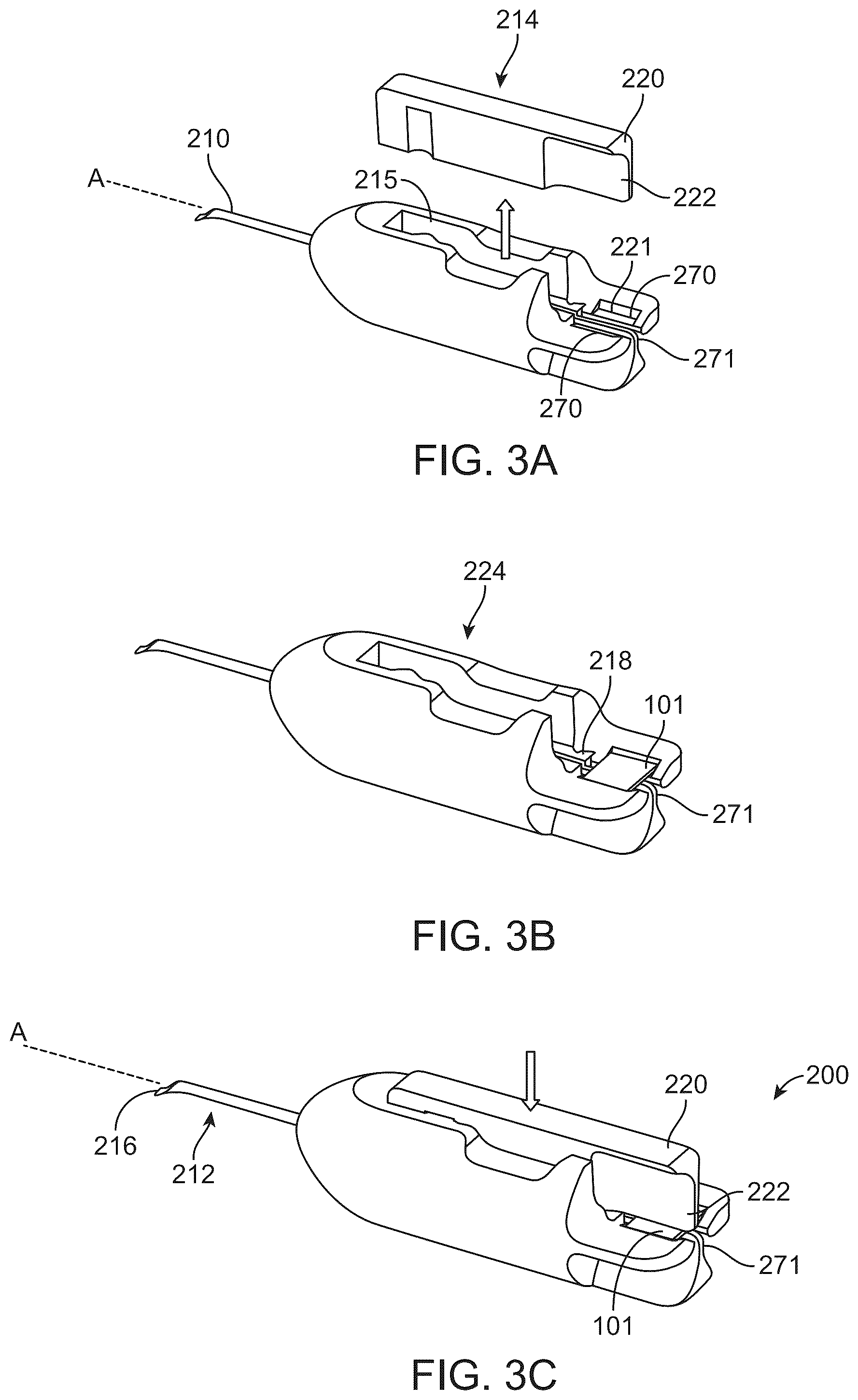 Patent US12318328 Figure 4 – System for shaping and implanting biologic intraocular stent for increased aqueous outflow and lowering of intraocular pressure