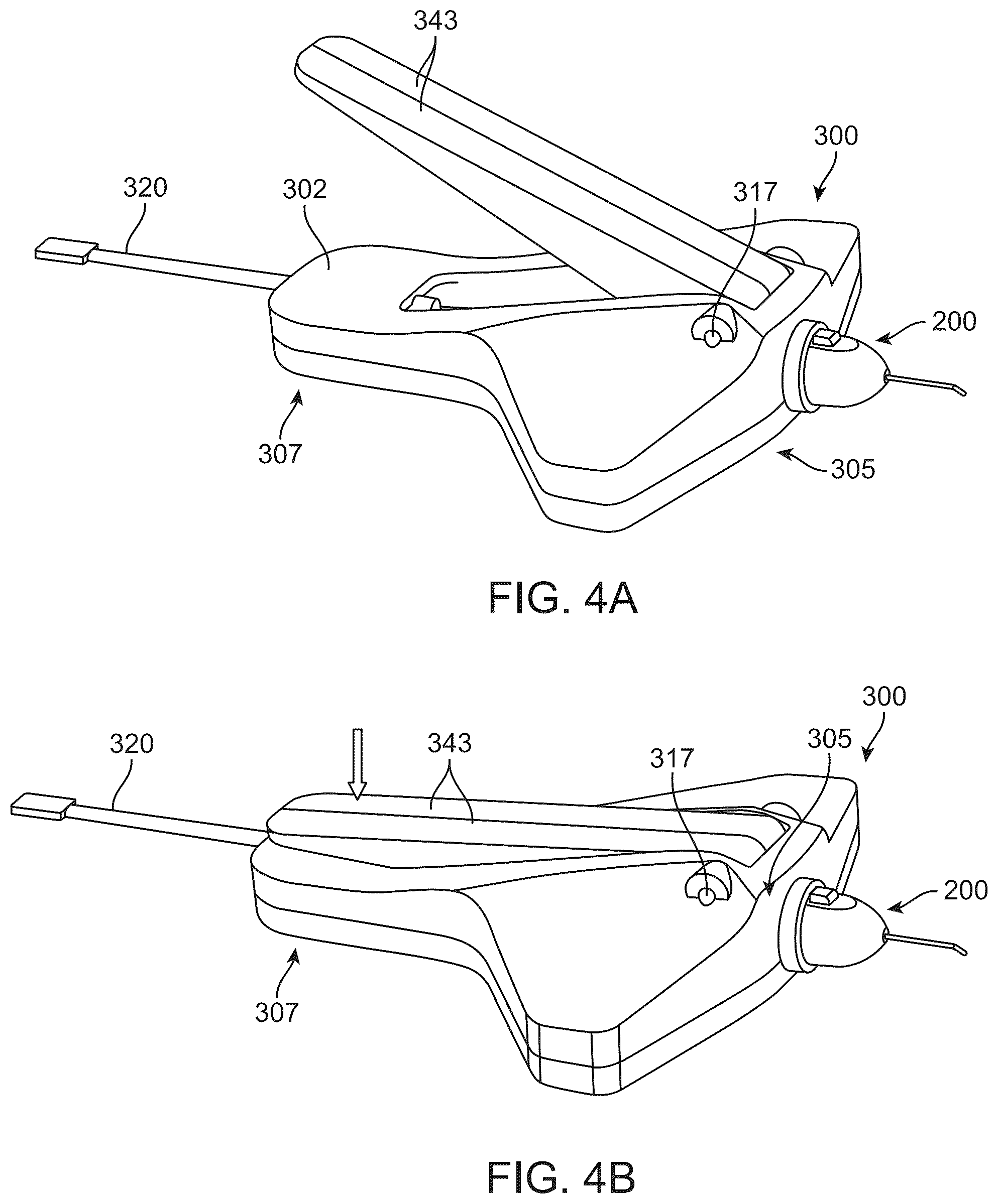 Patent US12318328 Figure 5 – System for shaping and implanting biologic intraocular stent for increased aqueous outflow and lowering of intraocular pressure