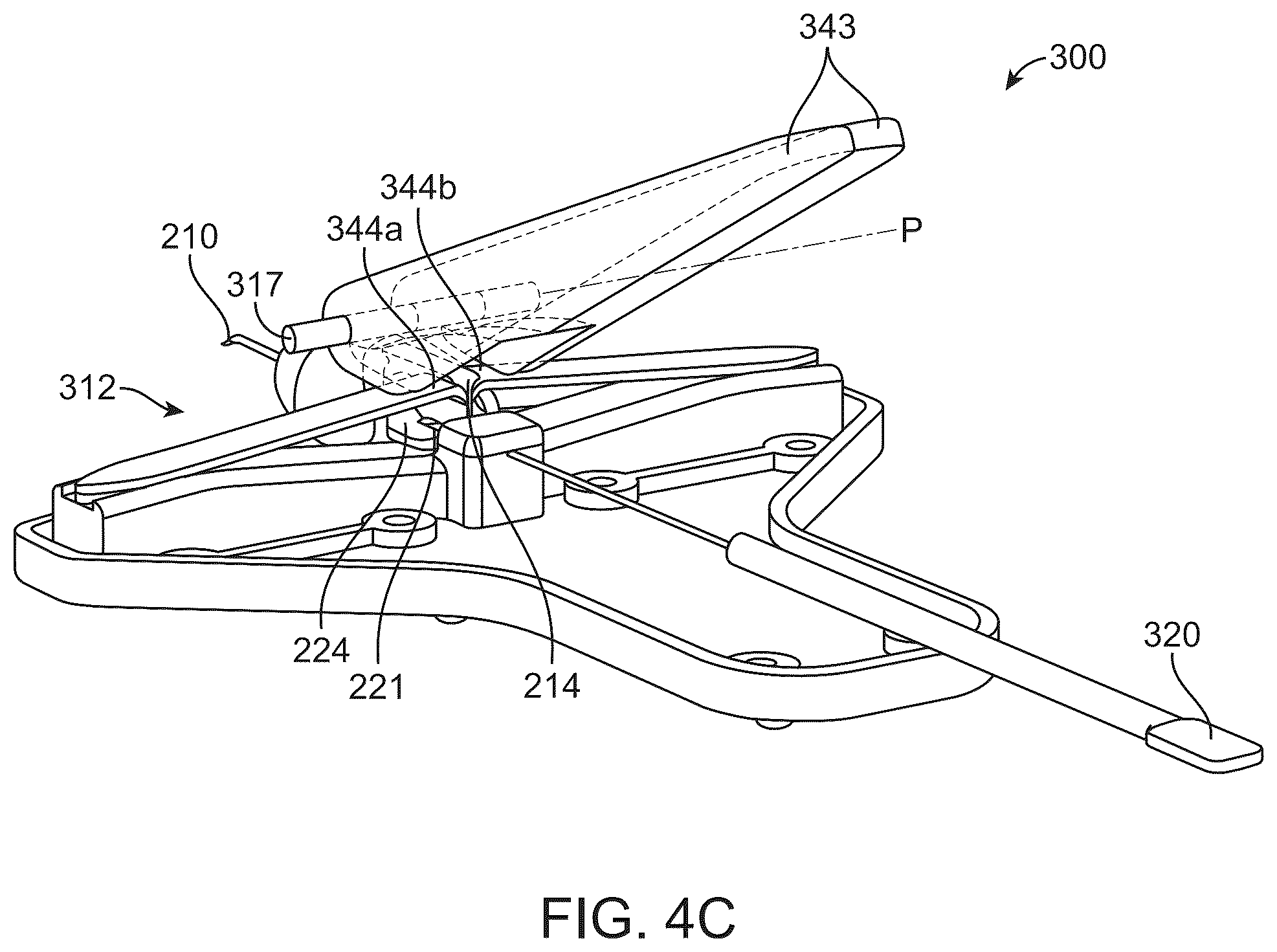 Patent US12318328 Figure 6 – System for shaping and implanting biologic intraocular stent for increased aqueous outflow and lowering of intraocular pressure
