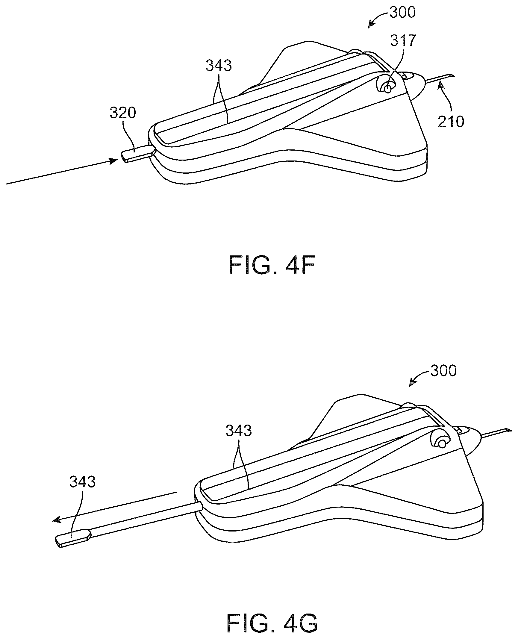 Patent US12318328 Figure 8 – System for shaping and implanting biologic intraocular stent for increased aqueous outflow and lowering of intraocular pressure