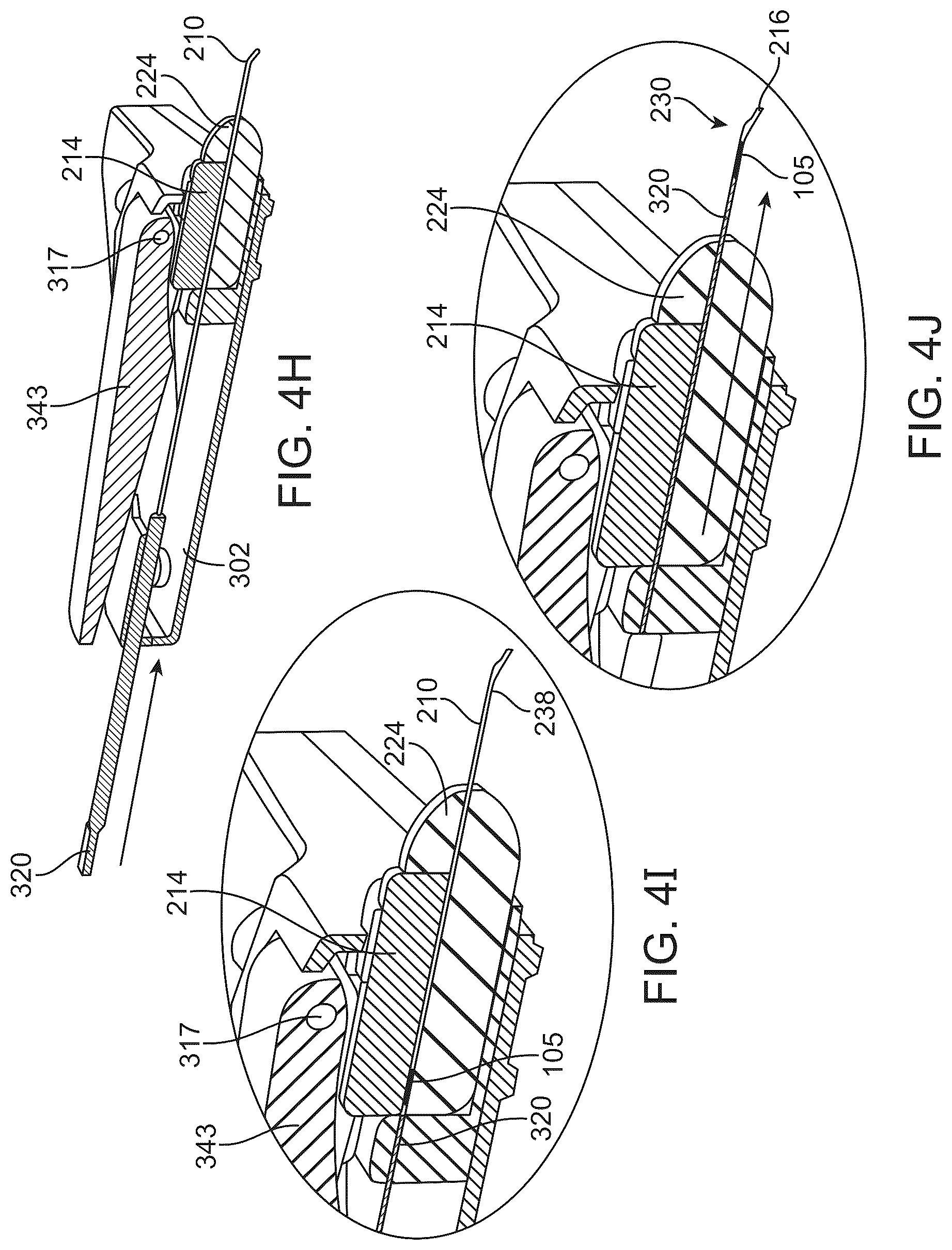 Patent US12318328 Figure 9 – System for shaping and implanting biologic intraocular stent for increased aqueous outflow and lowering of intraocular pressure