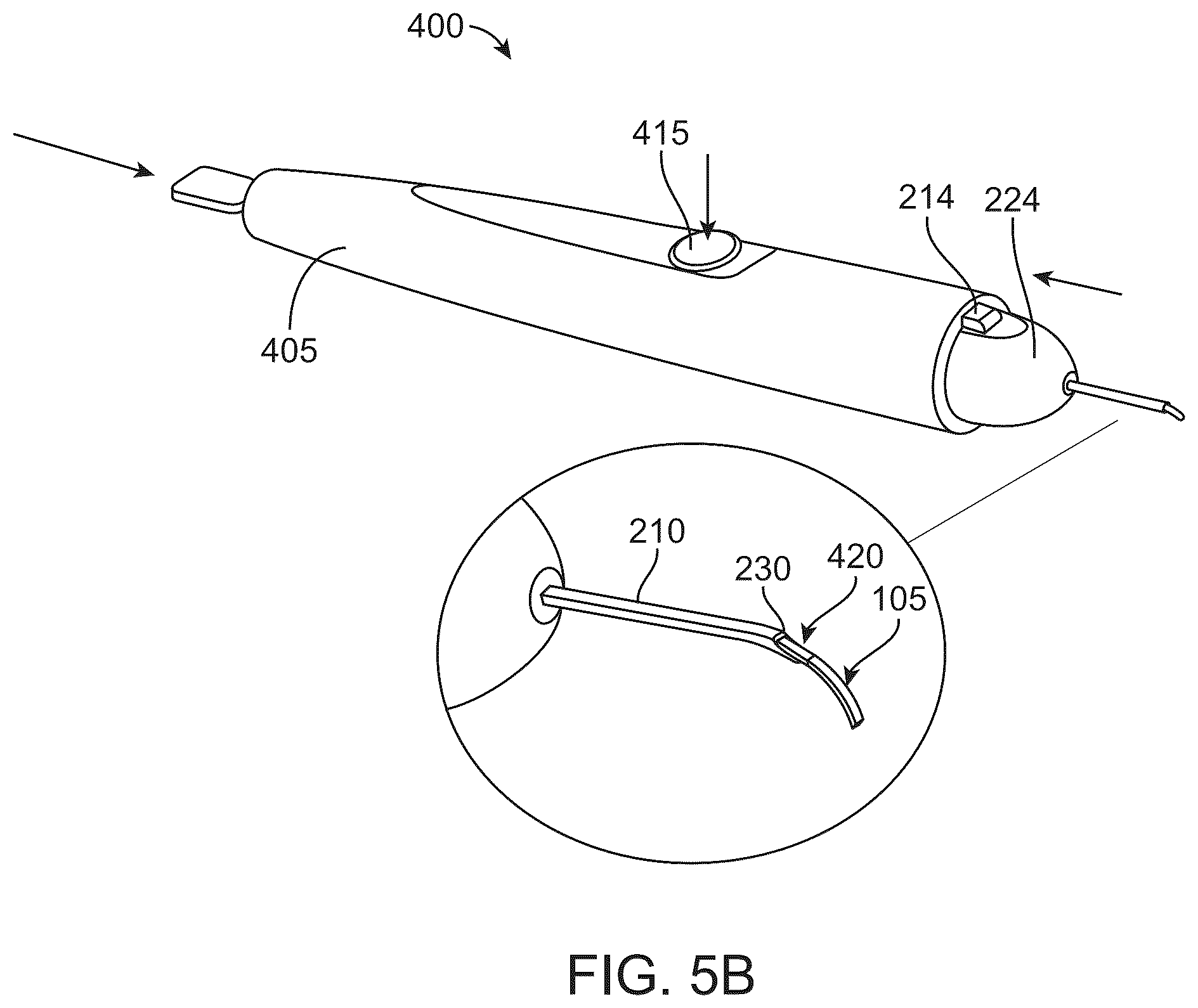 Patent US12318328 Figure 11 – System for shaping and implanting biologic intraocular stent for increased aqueous outflow and lowering of intraocular pressure