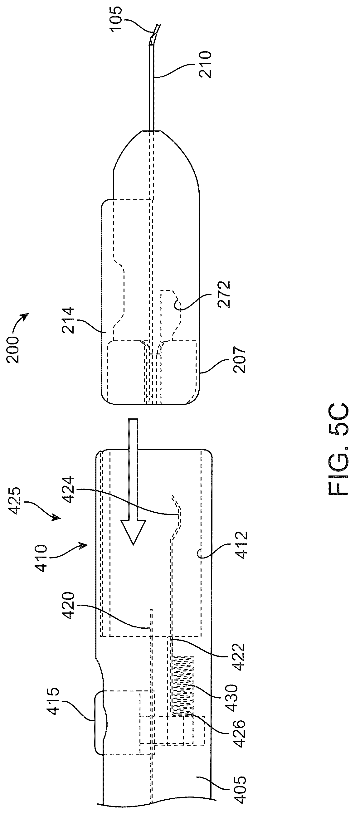 Patent US12318328 Figure 12 – System for shaping and implanting biologic intraocular stent for increased aqueous outflow and lowering of intraocular pressure