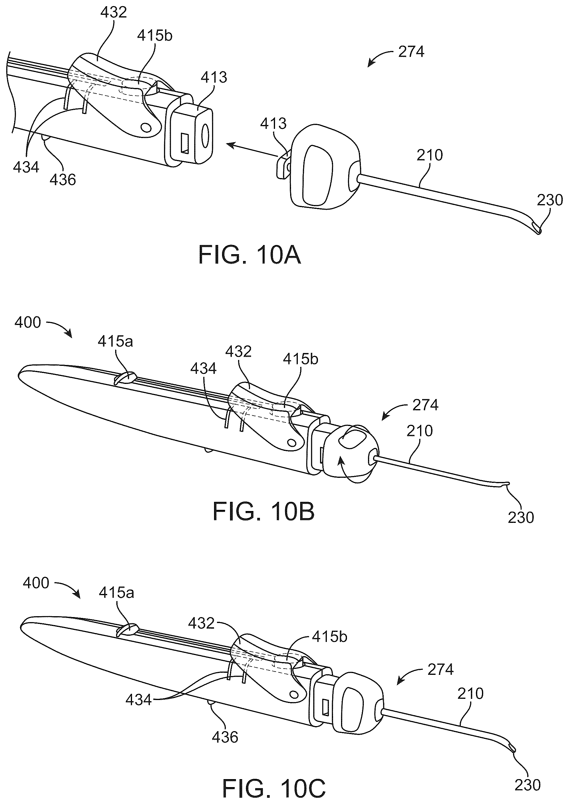 Patent US12318328 Figure 17 – System for shaping and implanting biologic intraocular stent for increased aqueous outflow and lowering of intraocular pressure
