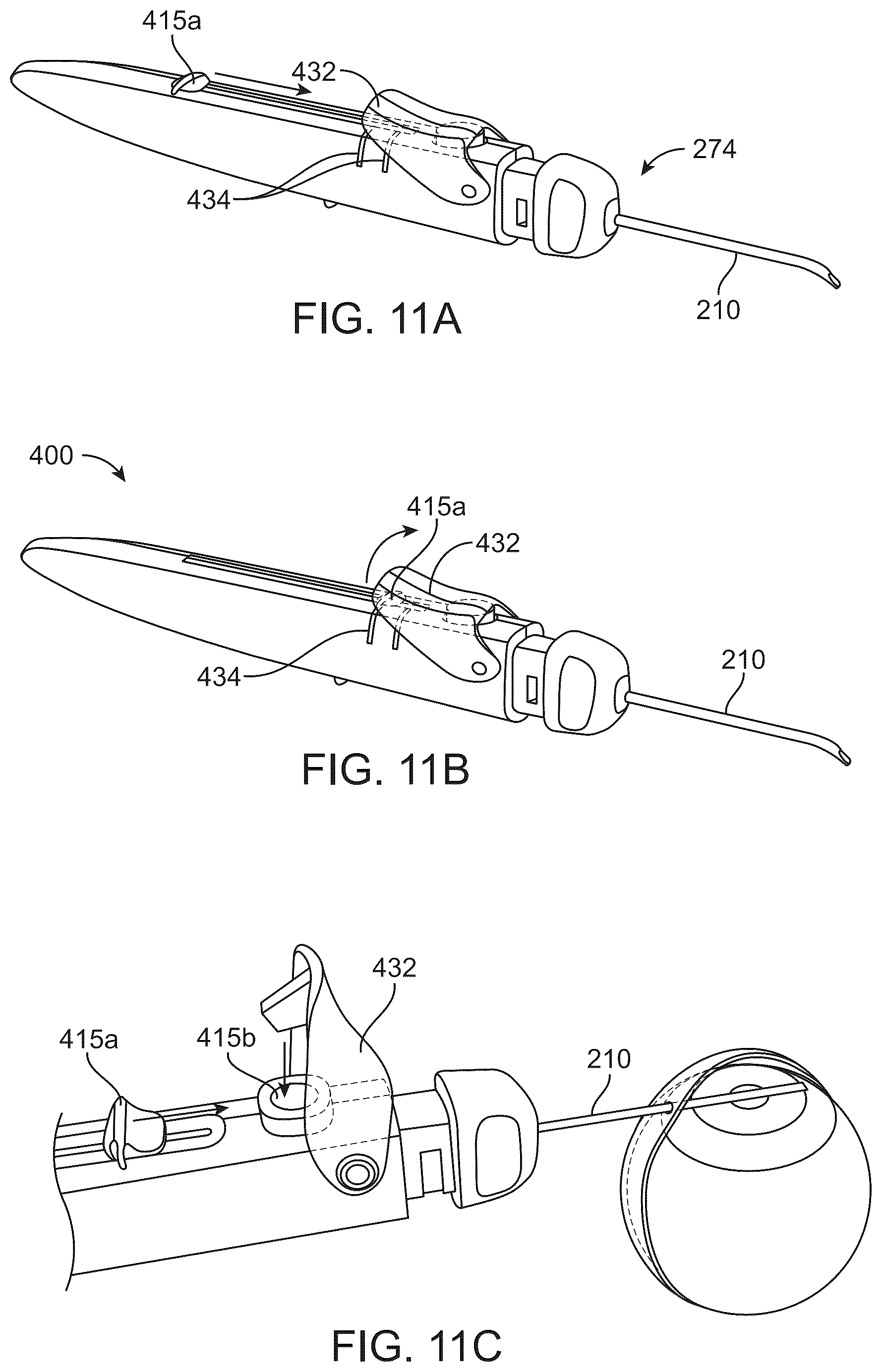 Patent US12318328 Figure 18 – System for shaping and implanting biologic intraocular stent for increased aqueous outflow and lowering of intraocular pressure