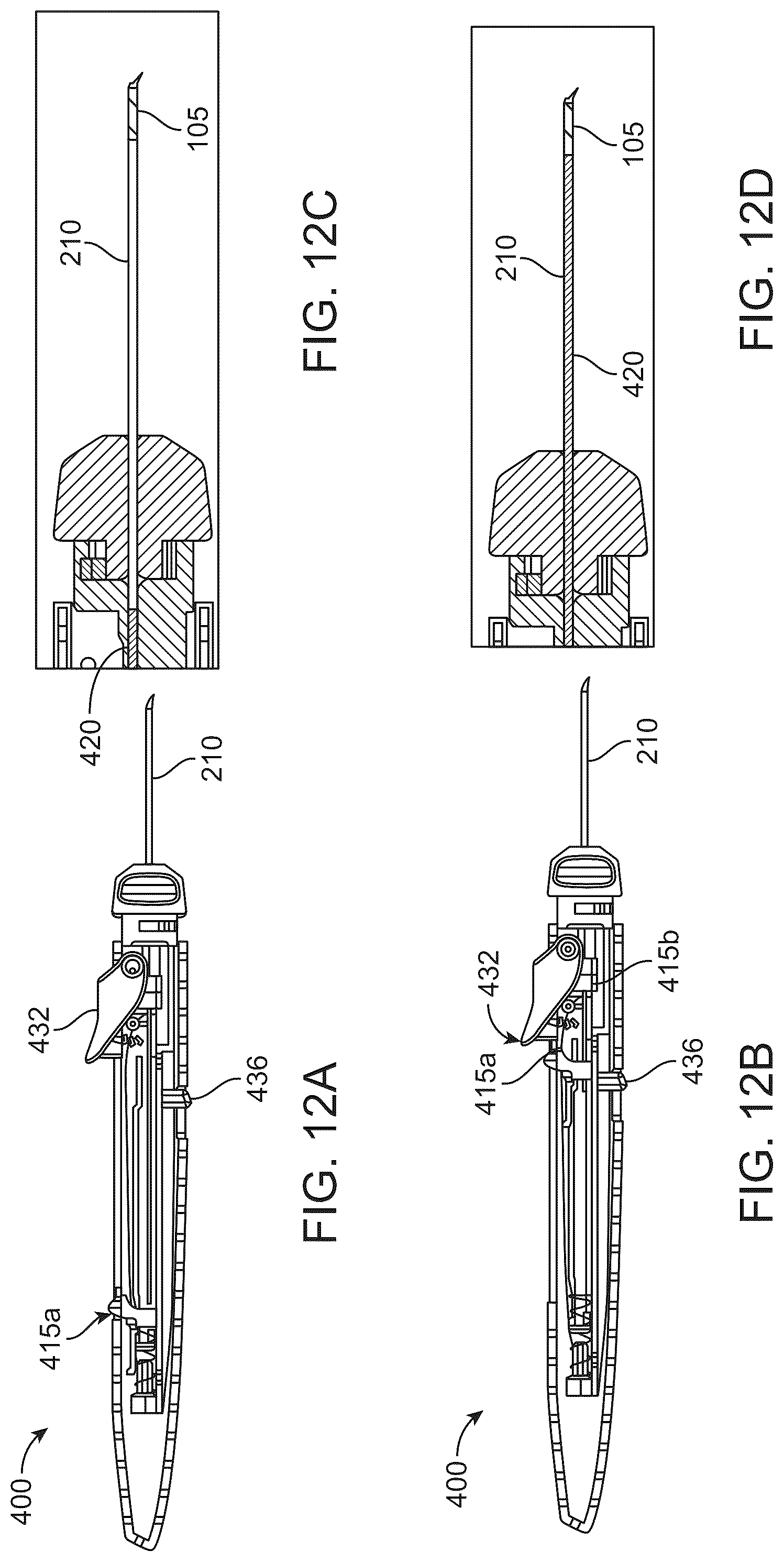 Patent US12318328 Figure 19 – System for shaping and implanting biologic intraocular stent for increased aqueous outflow and lowering of intraocular pressure