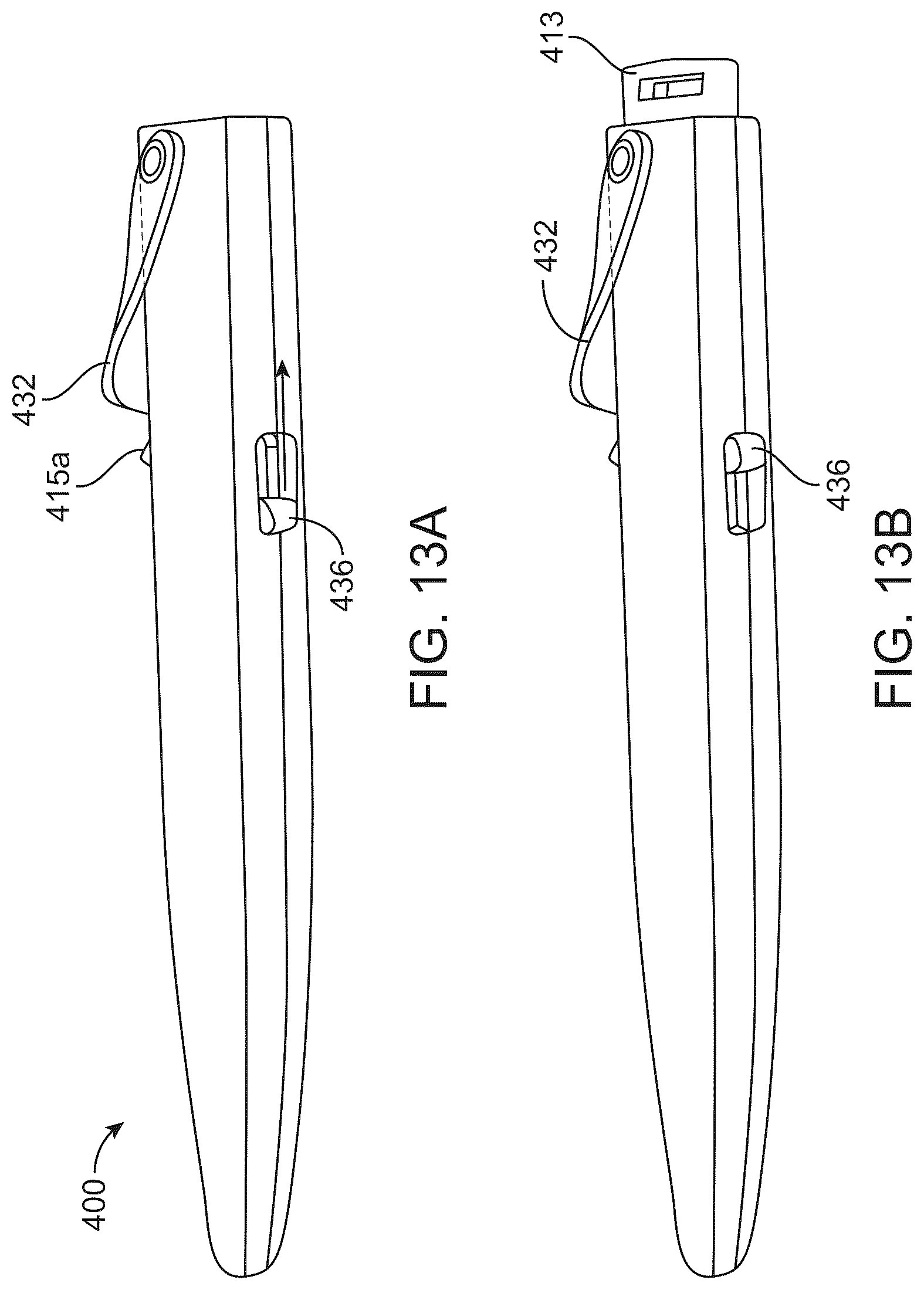 Patent US12318328 Figure 20 – System for shaping and implanting biologic intraocular stent for increased aqueous outflow and lowering of intraocular pressure