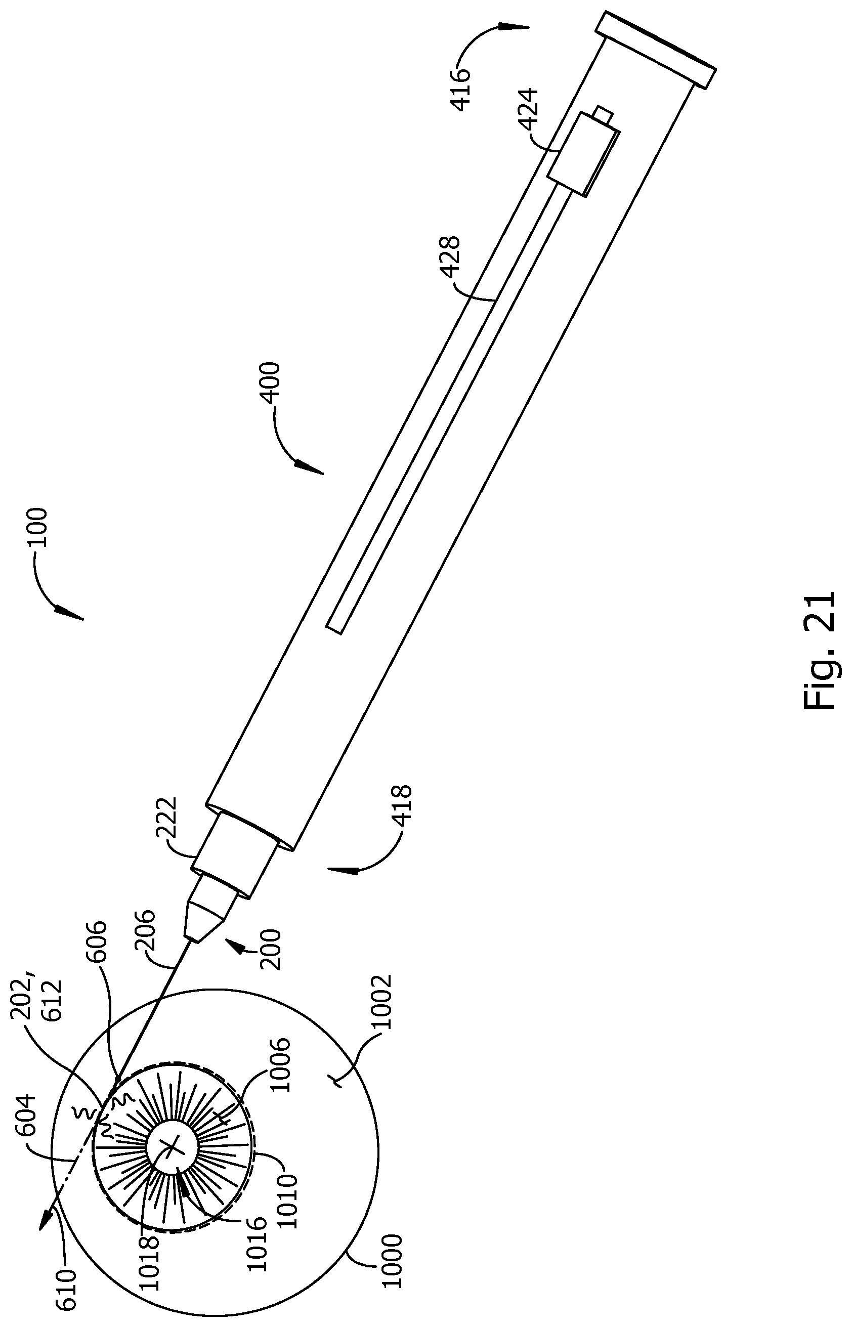 Patent US12318329 Figure 11 – Opthalmic microsurgical instrument