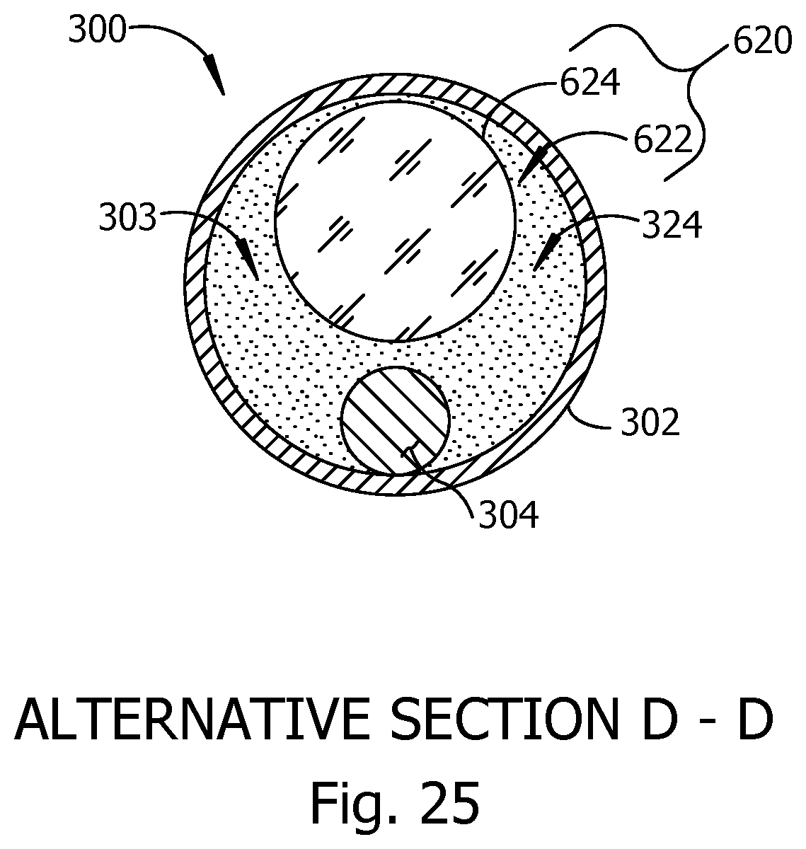 Patent US12318329 Figure 14 – Opthalmic microsurgical instrument