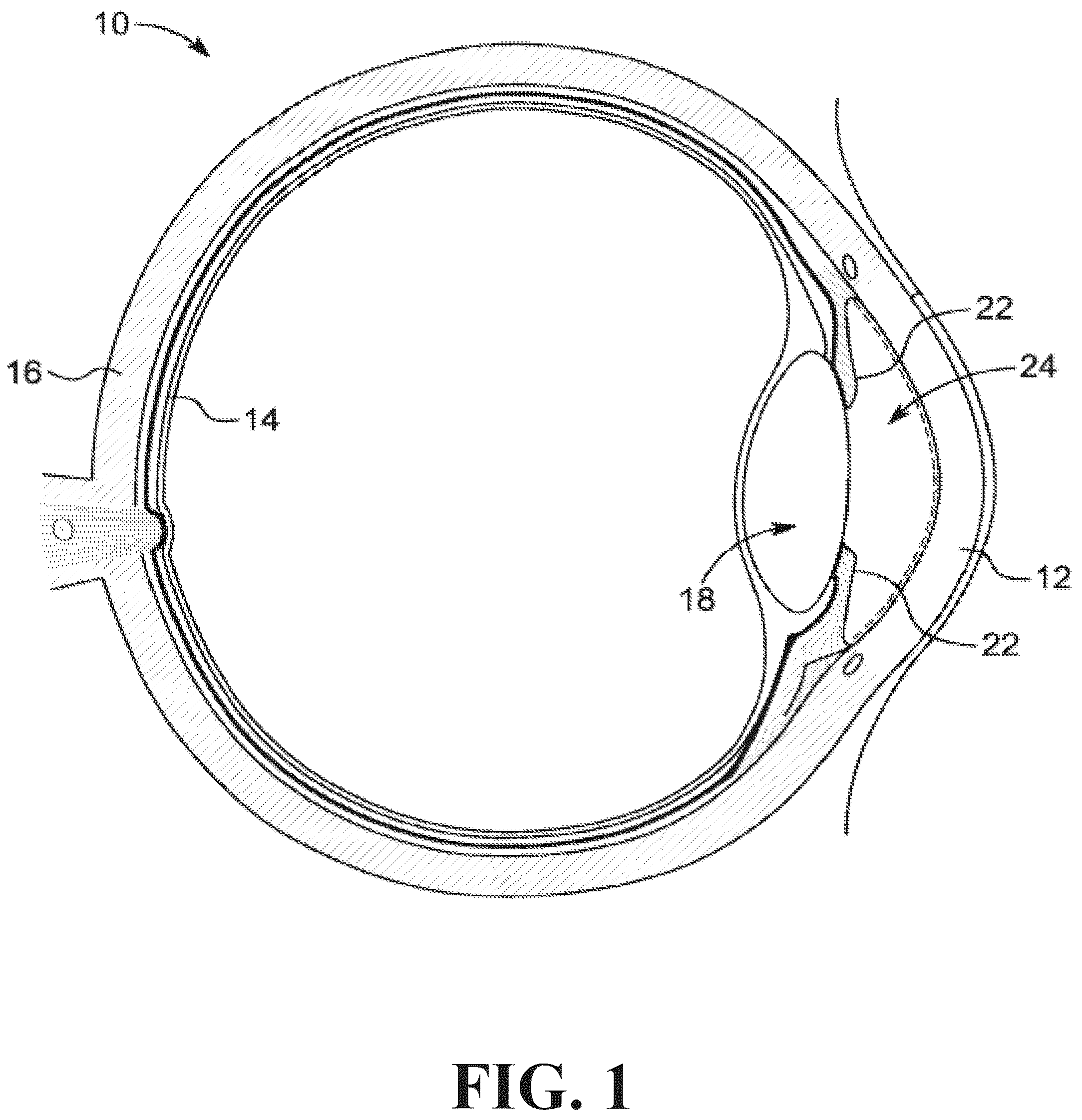 Patent US12318331 Figure 1 – Intraocular lens docking station