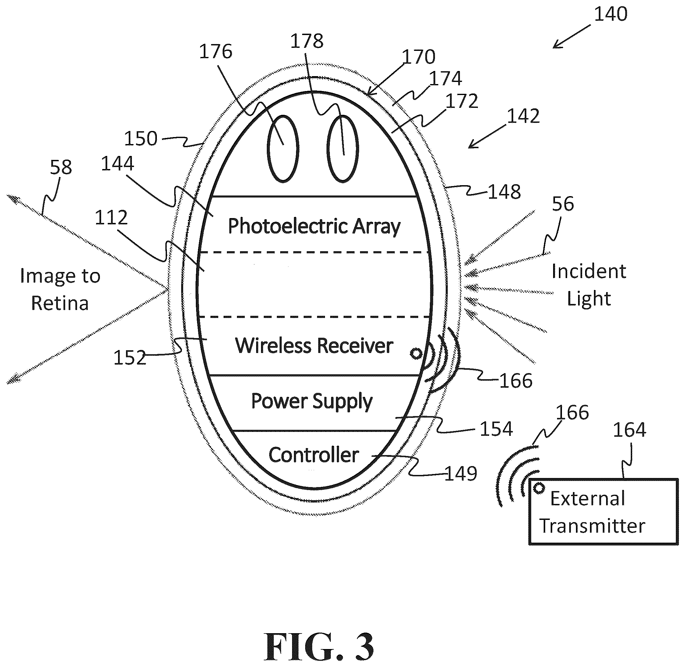 Patent US12318331 Figure 3 – Intraocular lens docking station