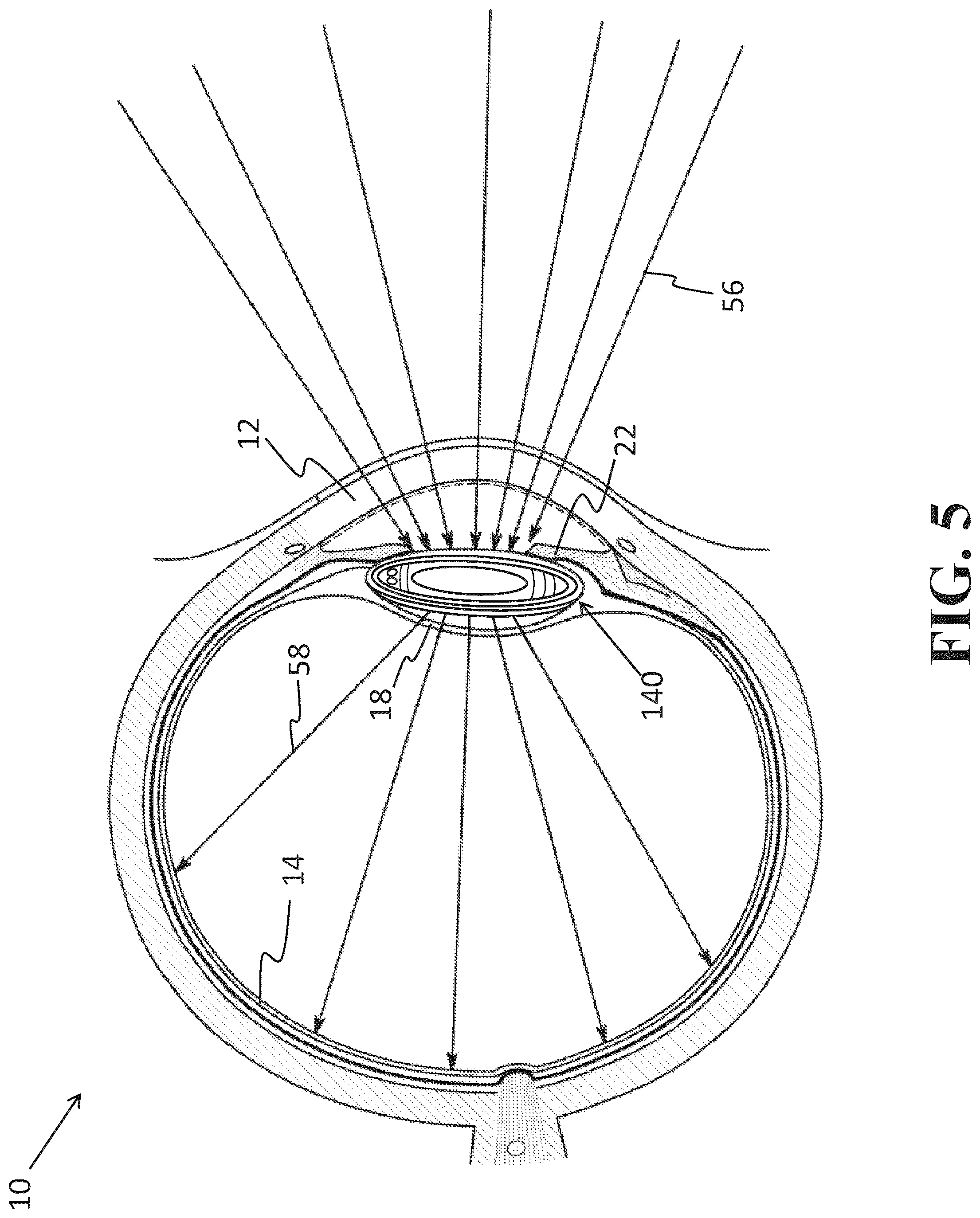 Patent US12318331 Figure 5 – Intraocular lens docking station