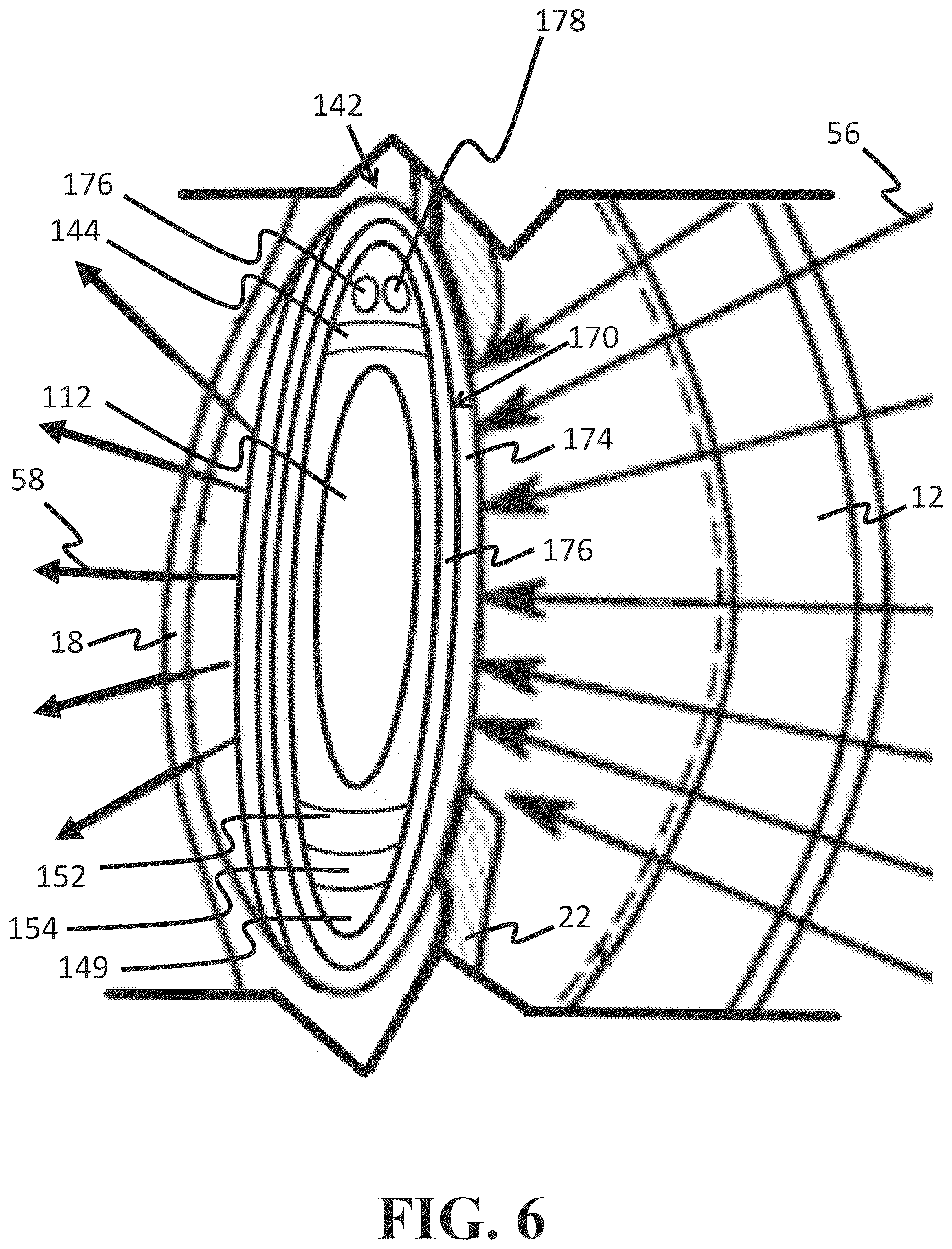 Patent US12318331 Figure 6 – Intraocular lens docking station