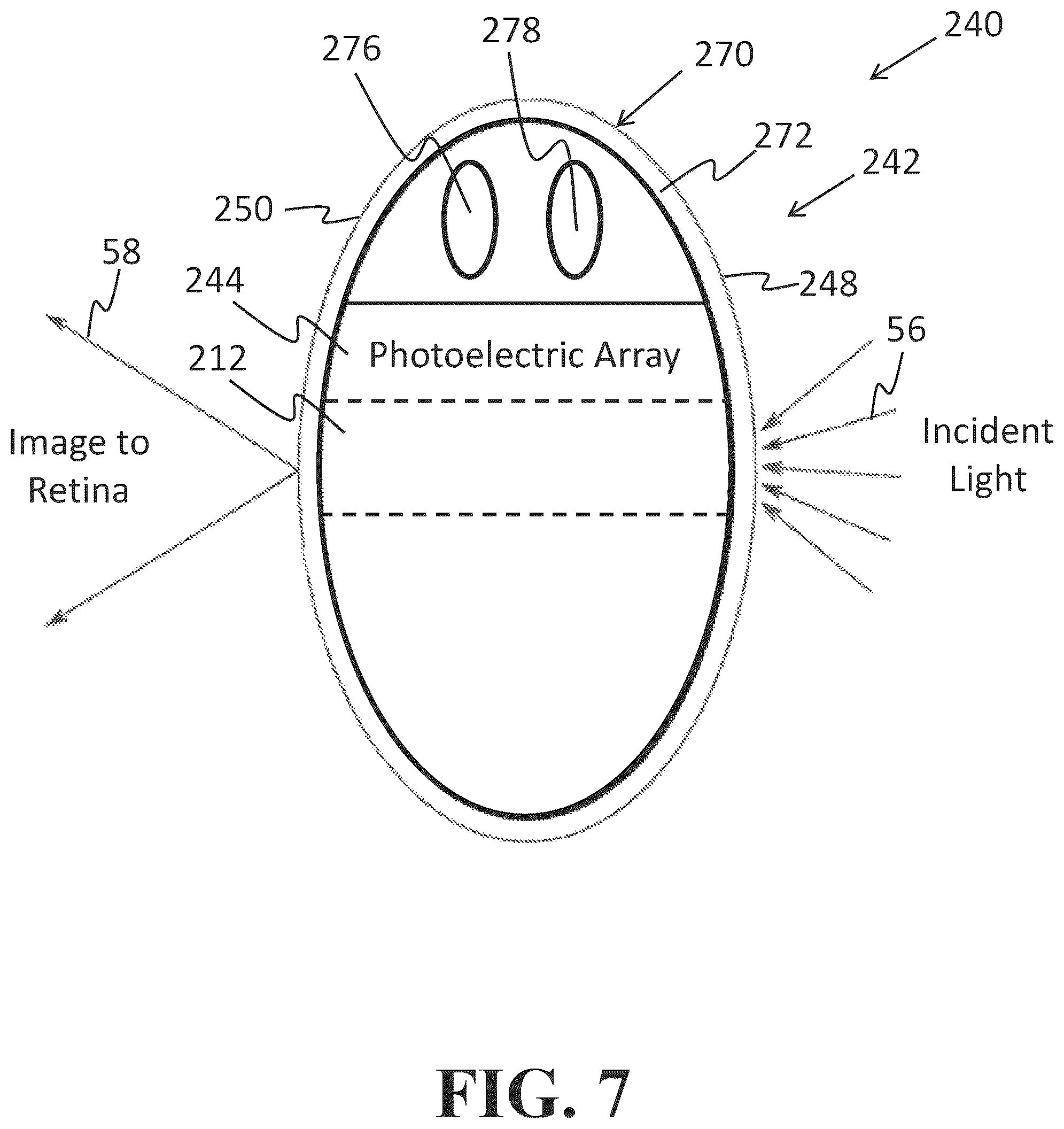 Patent US12318331 Figure 7 – Intraocular lens docking station
