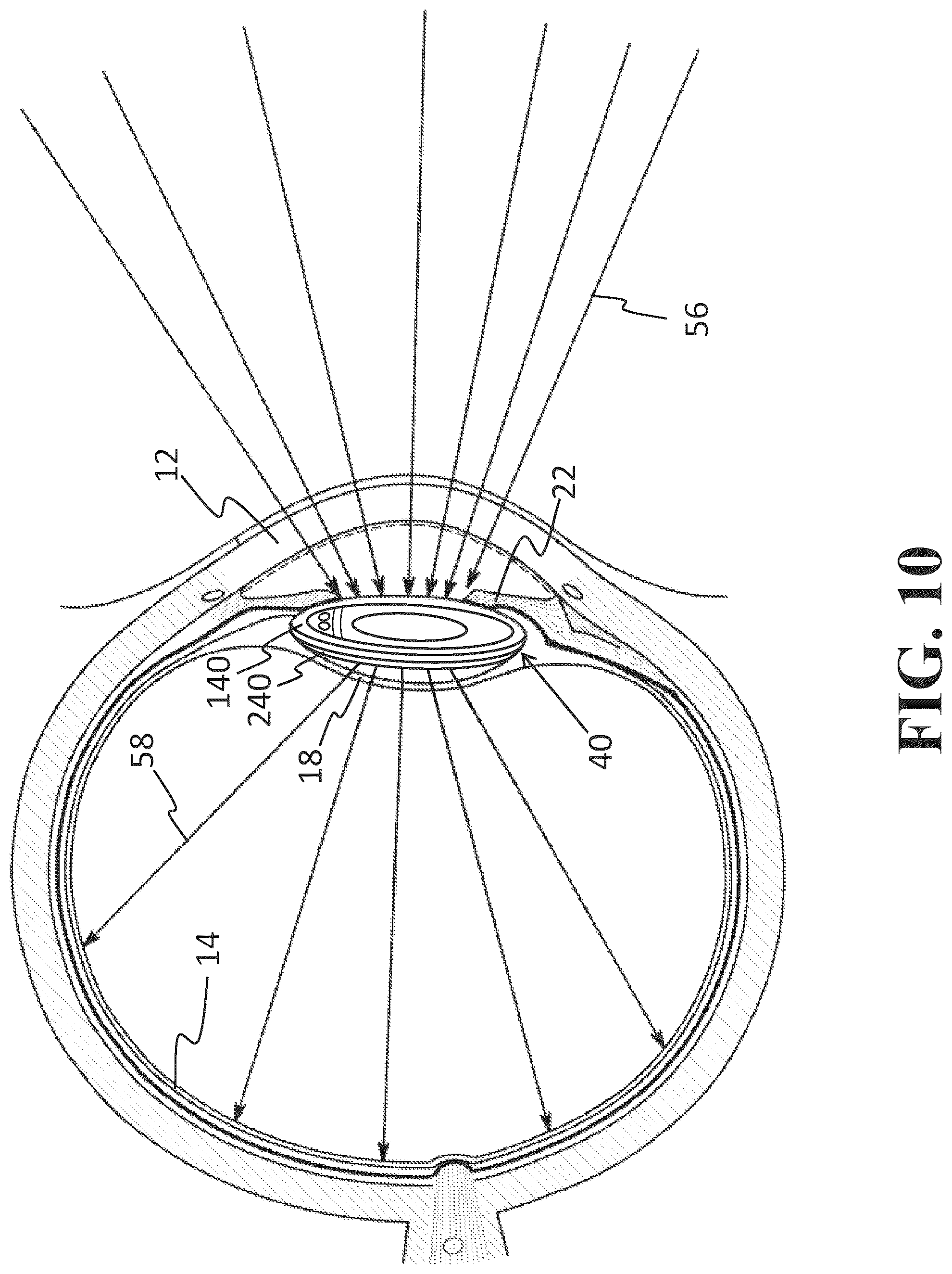 Patent US12318331 Figure 10 – Intraocular lens docking station