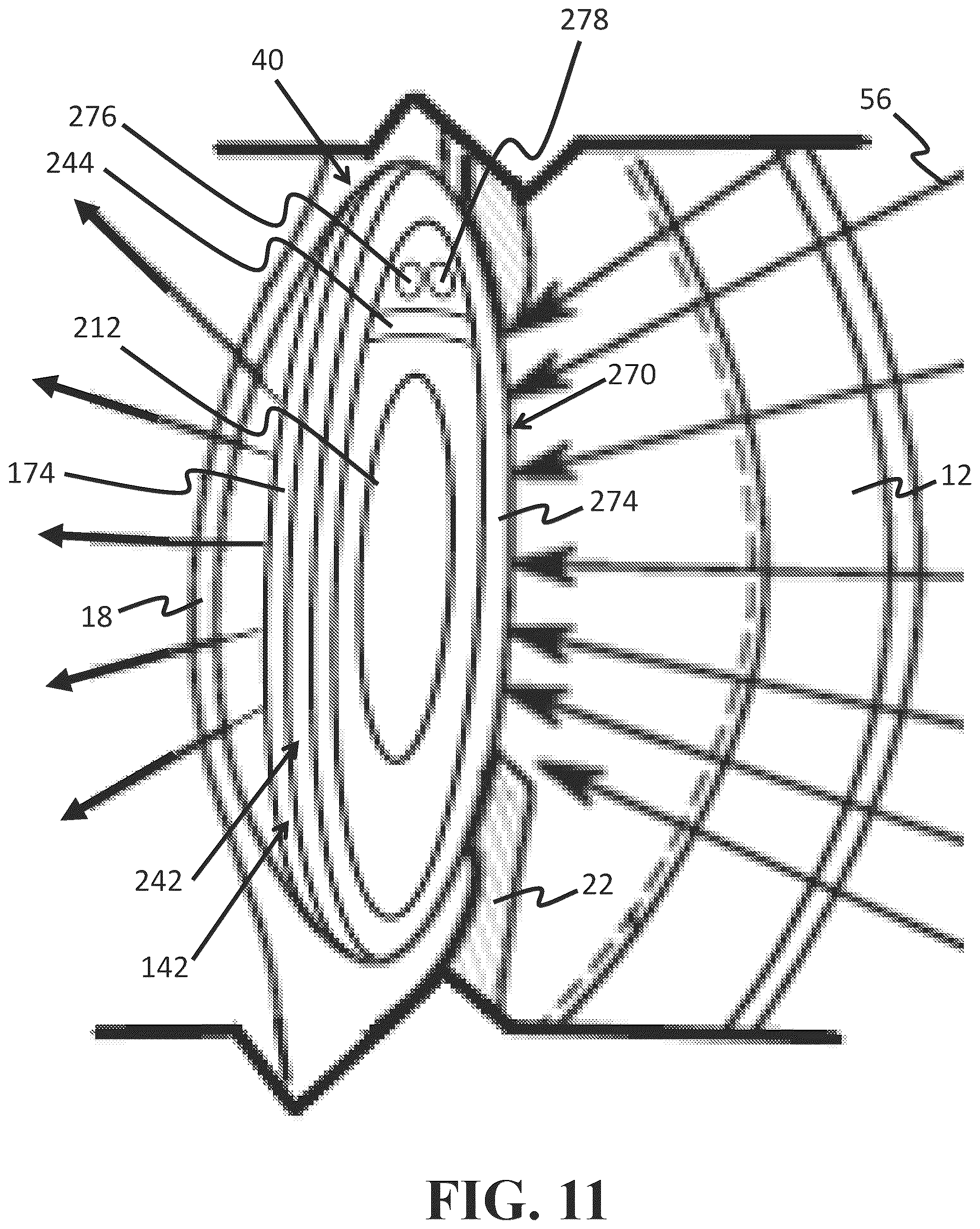 Patent US12318331 Figure 11 – Intraocular lens docking station