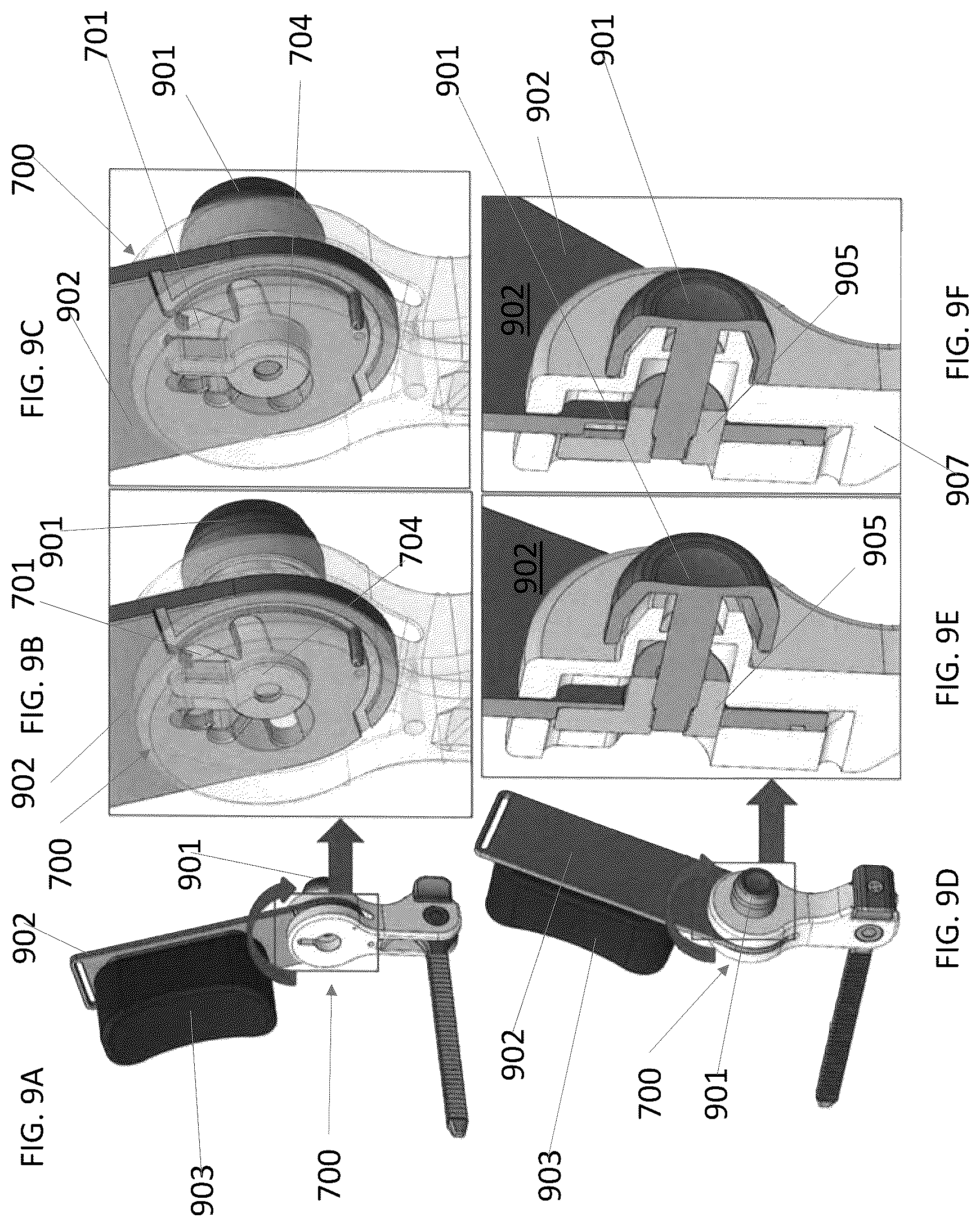 Patent US12318334 Figure 15 – Systems and methods for patient positioning