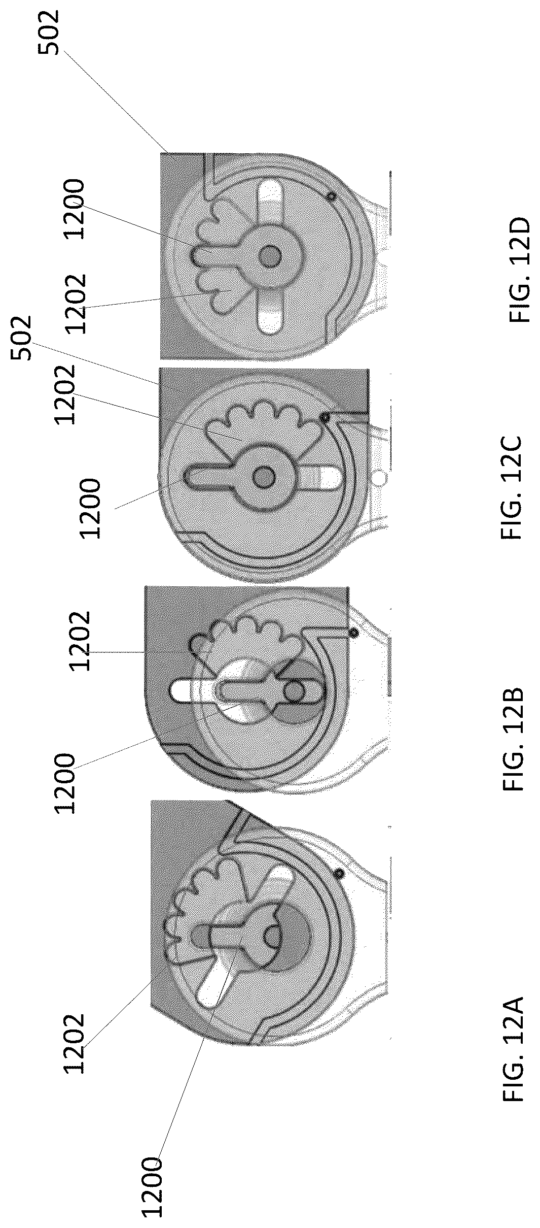 Patent US12318334 Figure 18 – Systems and methods for patient positioning
