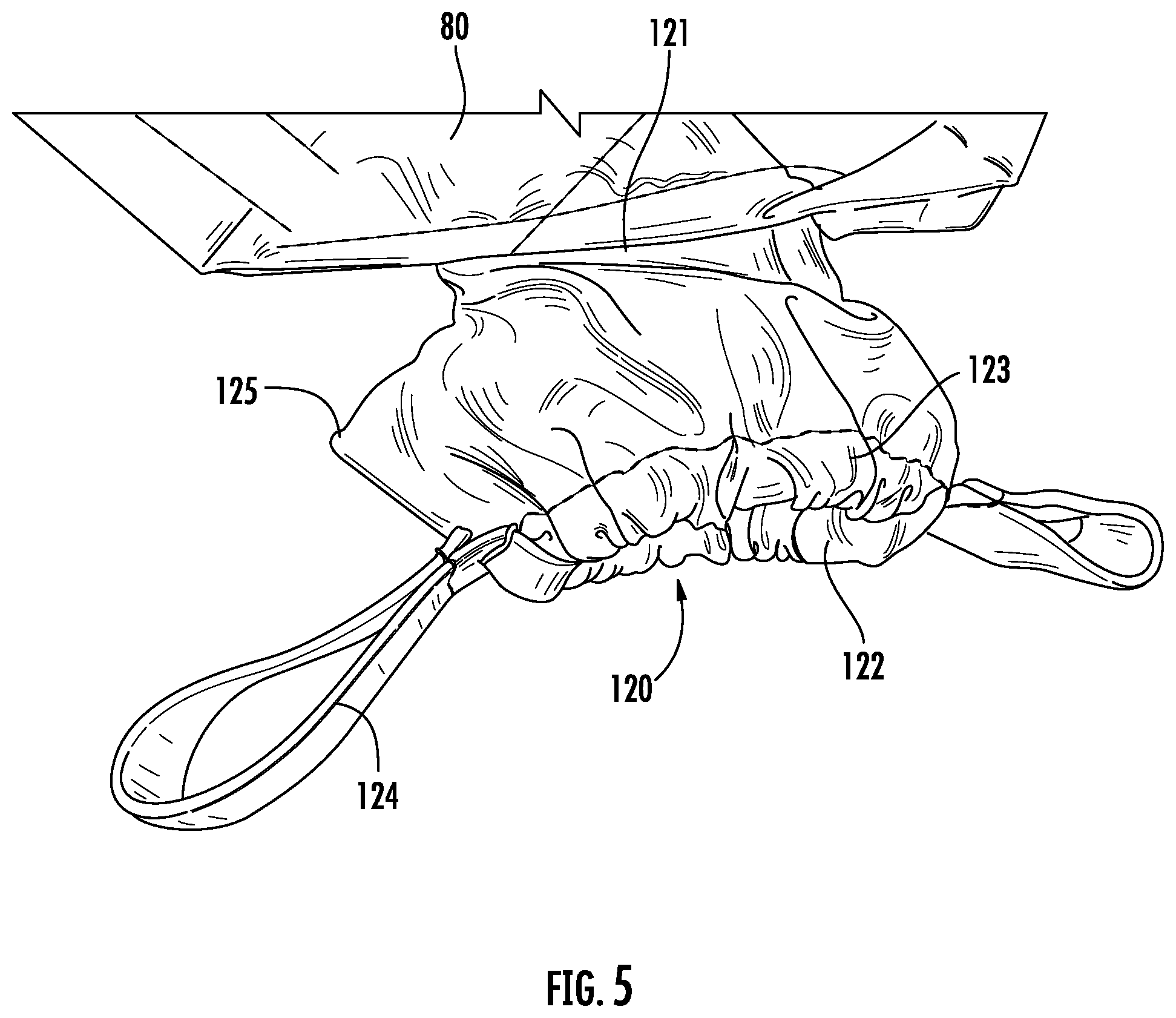 Patent US12318339 Figure 6 – Apparatus and method for positioning a patient