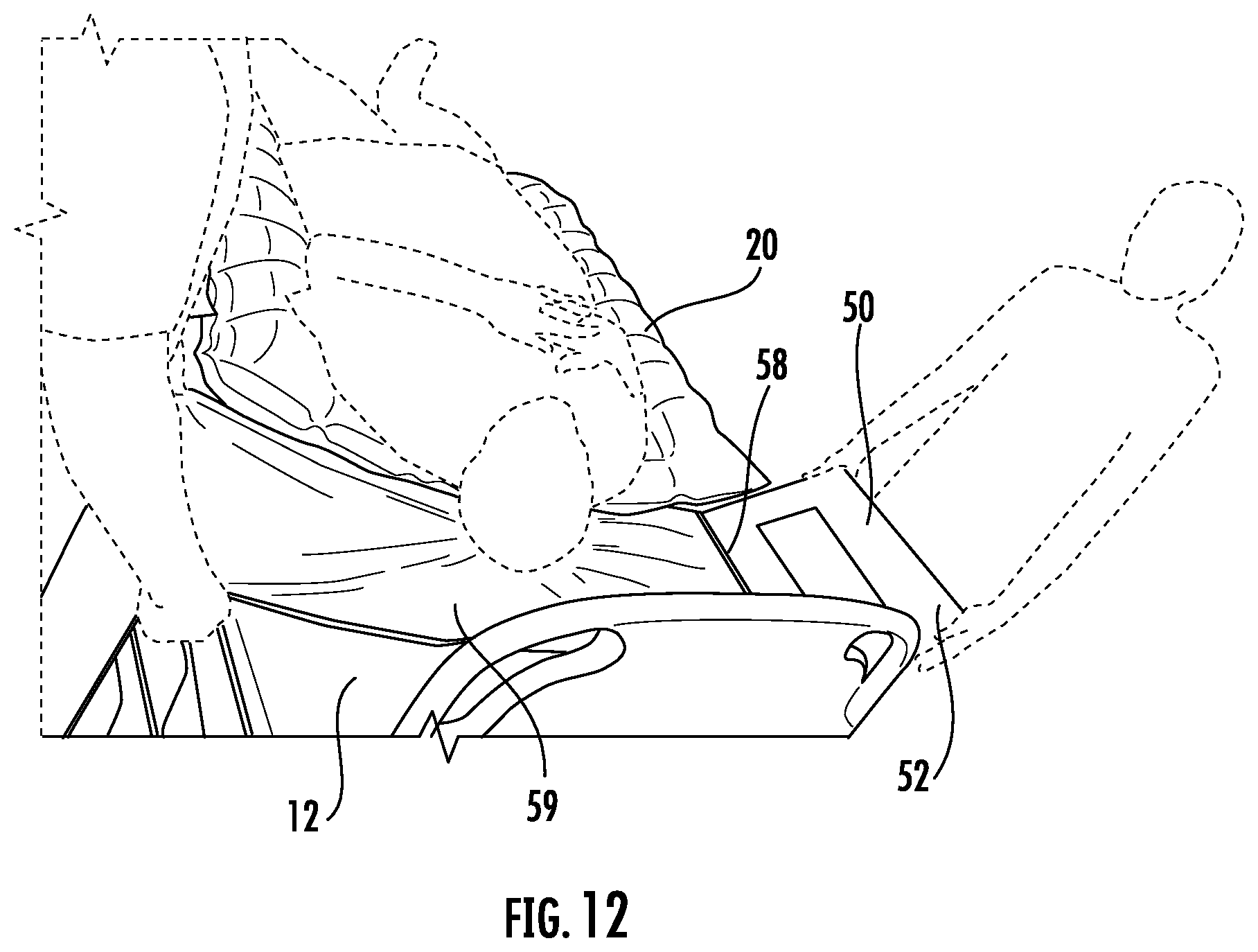 Patent US12318339 Figure 11 – Apparatus and method for positioning a patient