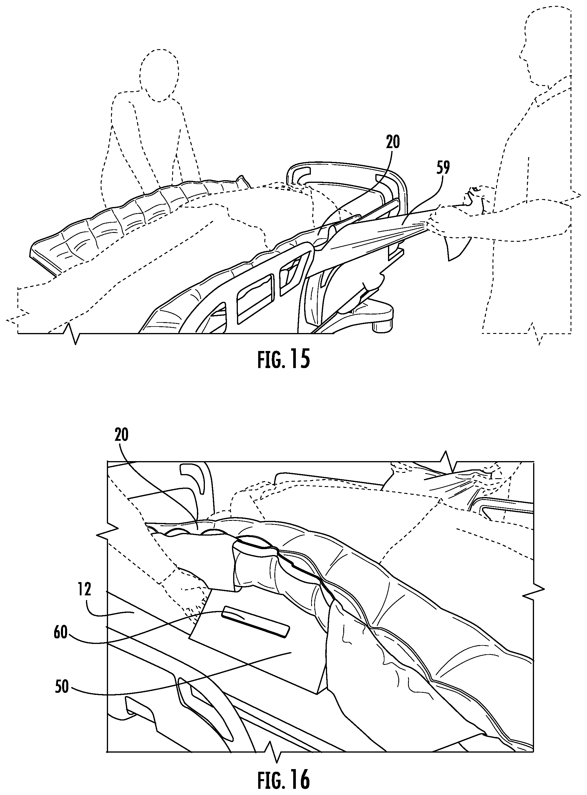 Patent US12318339 Figure 13 – Apparatus and method for positioning a patient