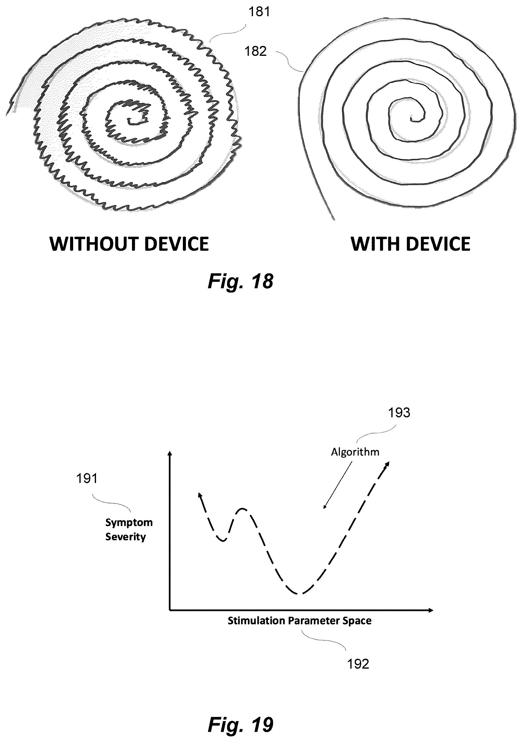 Patent US12318341 Figure 13 – Apparatus and method for reduction of neurological movement disorder symptoms using wearable device