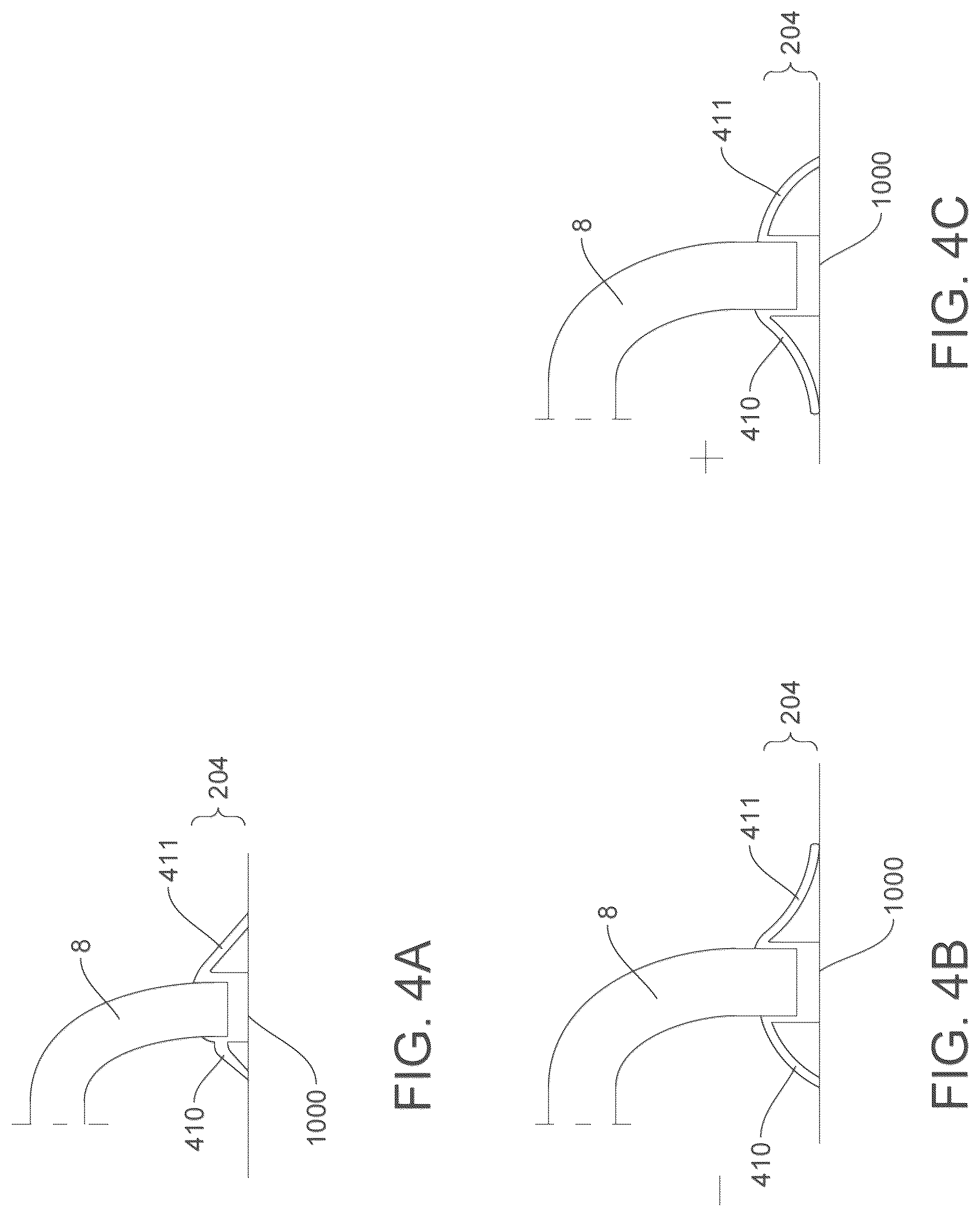 Patent US12318348 Figure 4 – On ambulatory respiratory assist device