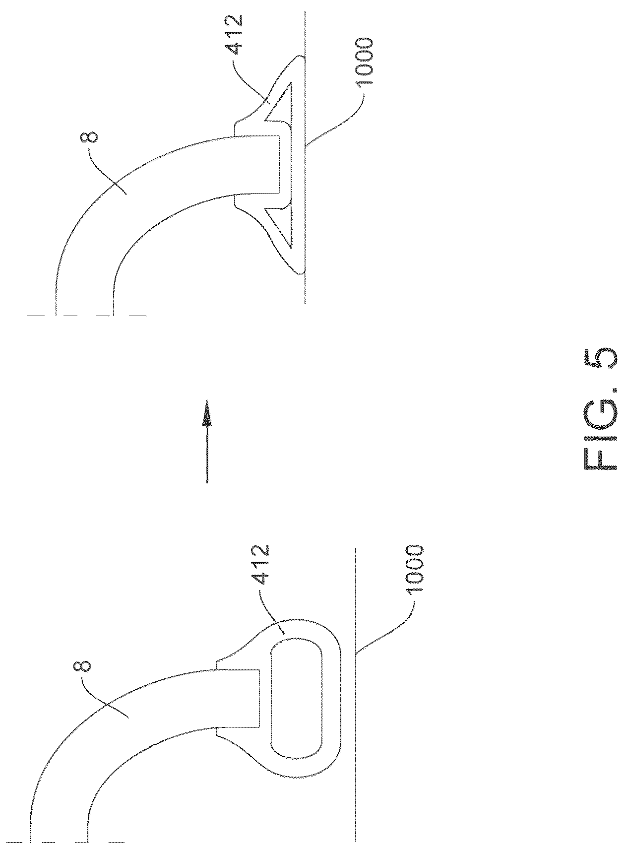 Patent US12318348 Figure 5 – On ambulatory respiratory assist device