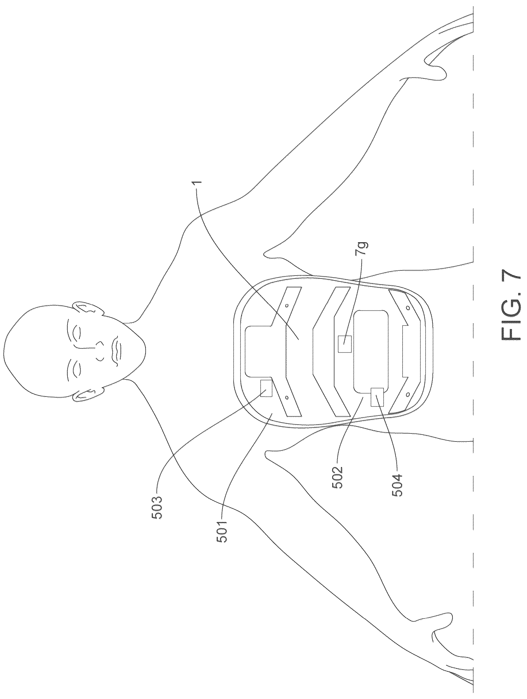 Patent US12318348 Figure 7 – On ambulatory respiratory assist device