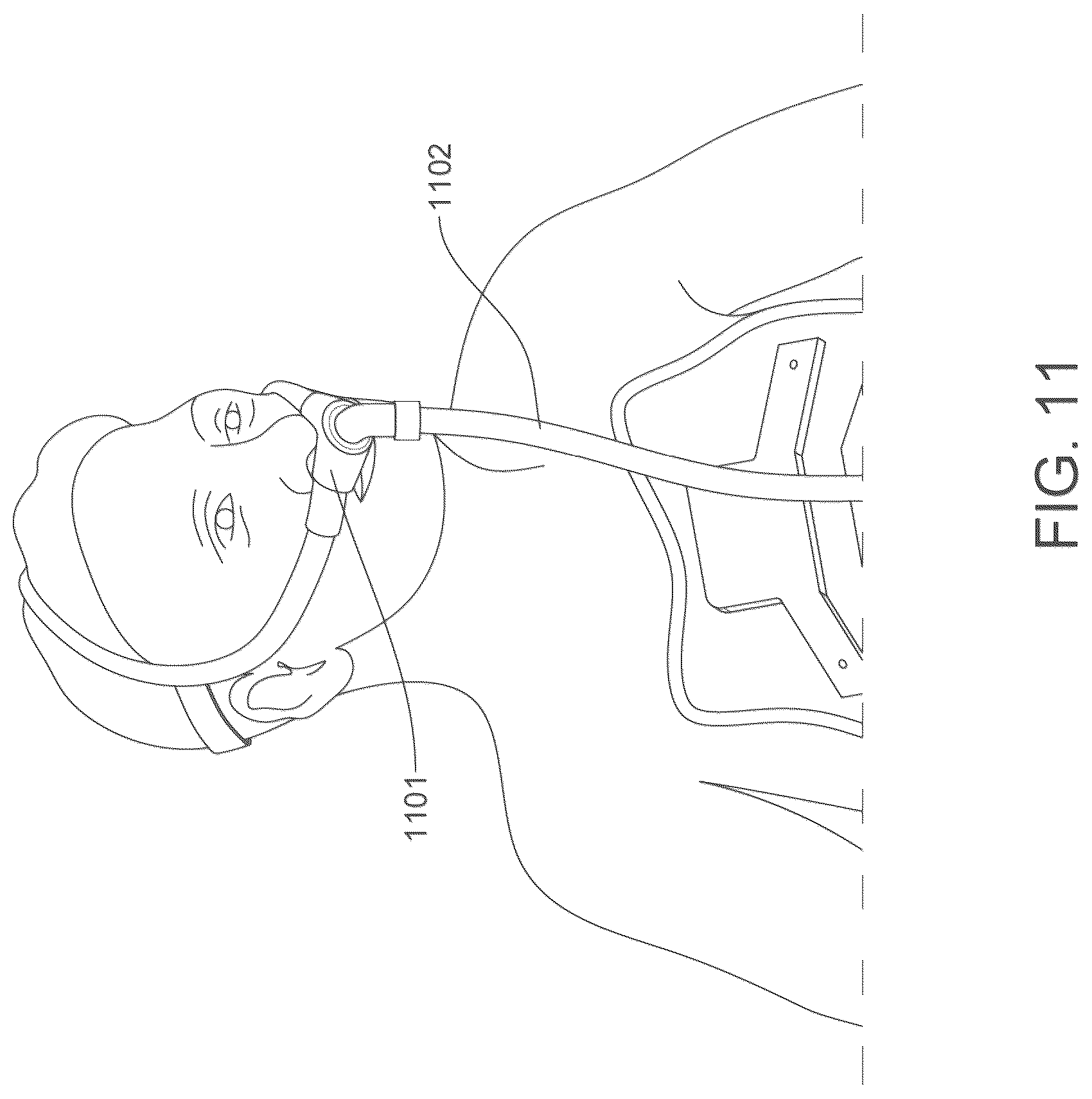 Patent US12318348 Figure 11 – On ambulatory respiratory assist device