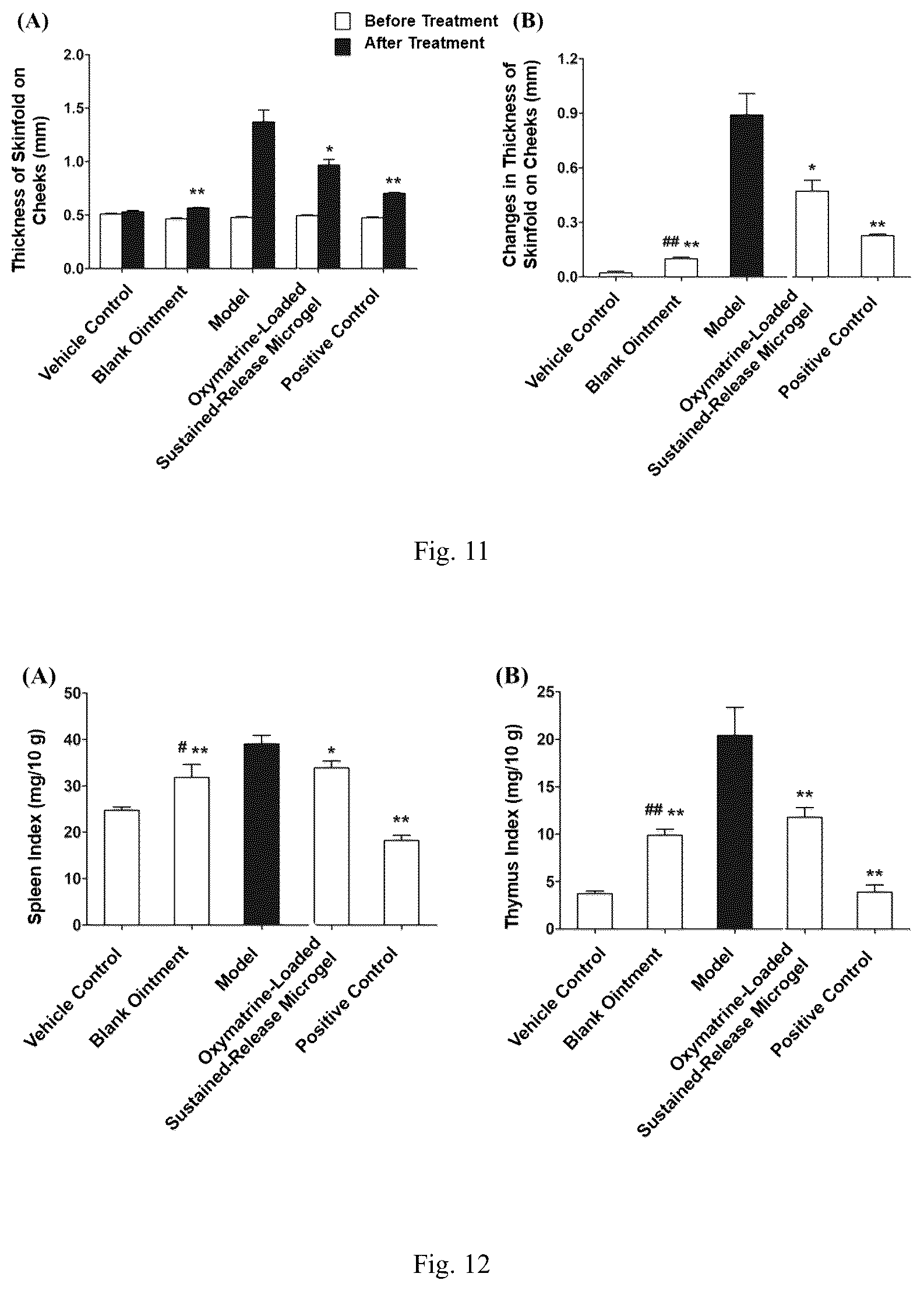 Patent US12318371 Figure 6 – Sustained-release microgel ointments with high drug loading and preparation methods and uses thereof