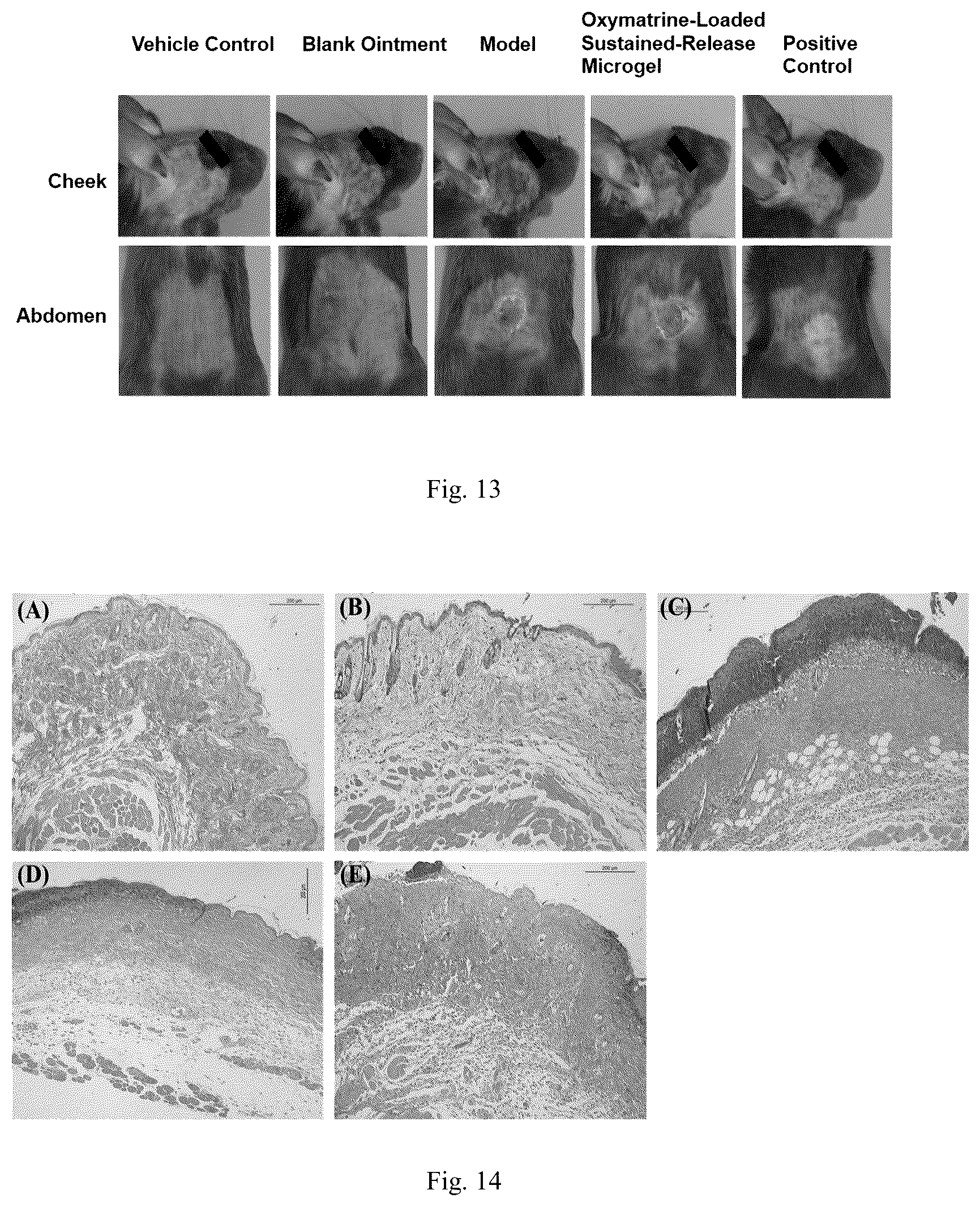 Patent US12318371 Figure 7 – Sustained-release microgel ointments with high drug loading and preparation methods and uses thereof