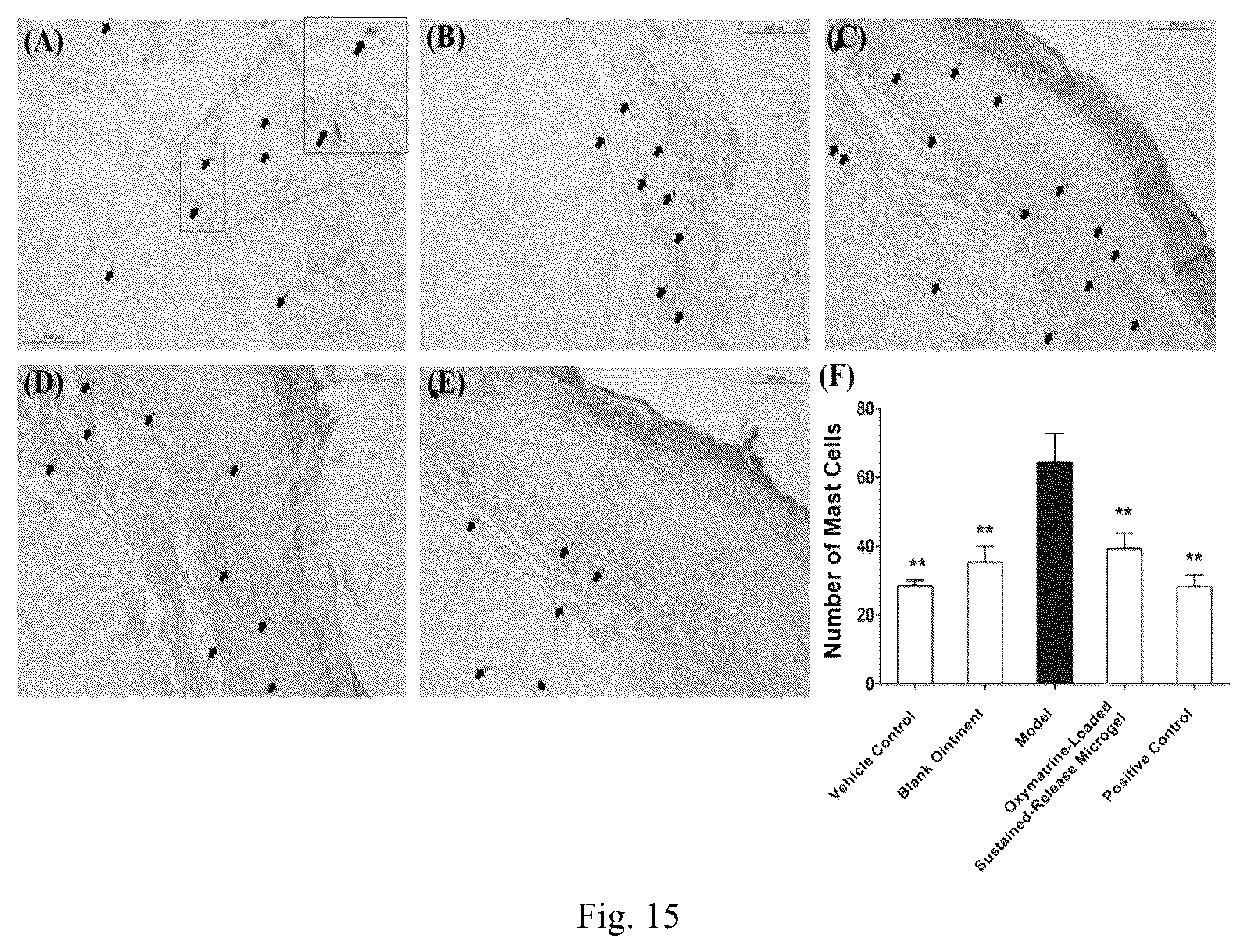 Patent US12318371 Figure 8 – Sustained-release microgel ointments with high drug loading and preparation methods and uses thereof