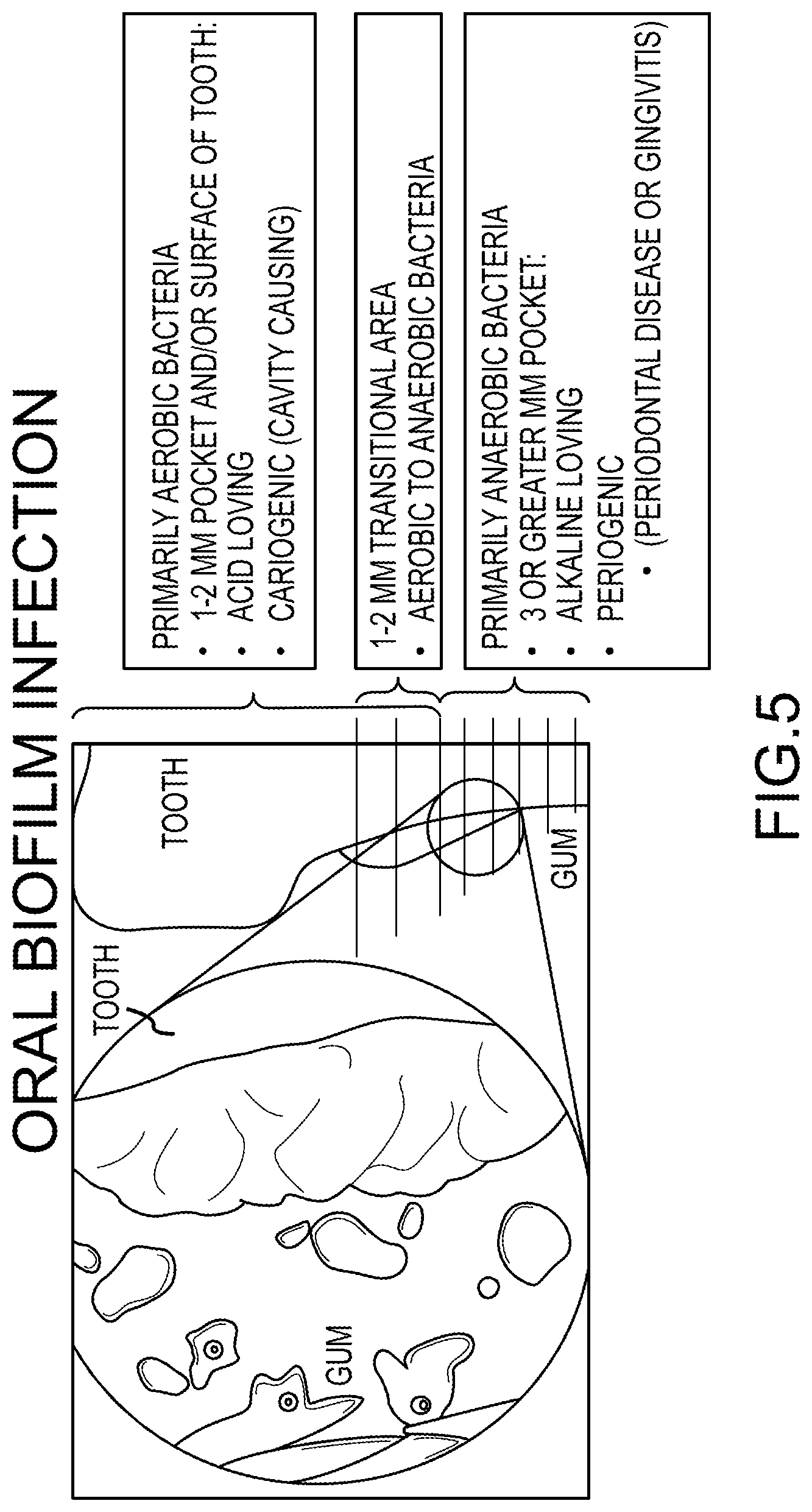 Patent US12318377 Figure 5 – Method and system for reducing the likelihood of a porphyromonas gingivalis infection in a human being