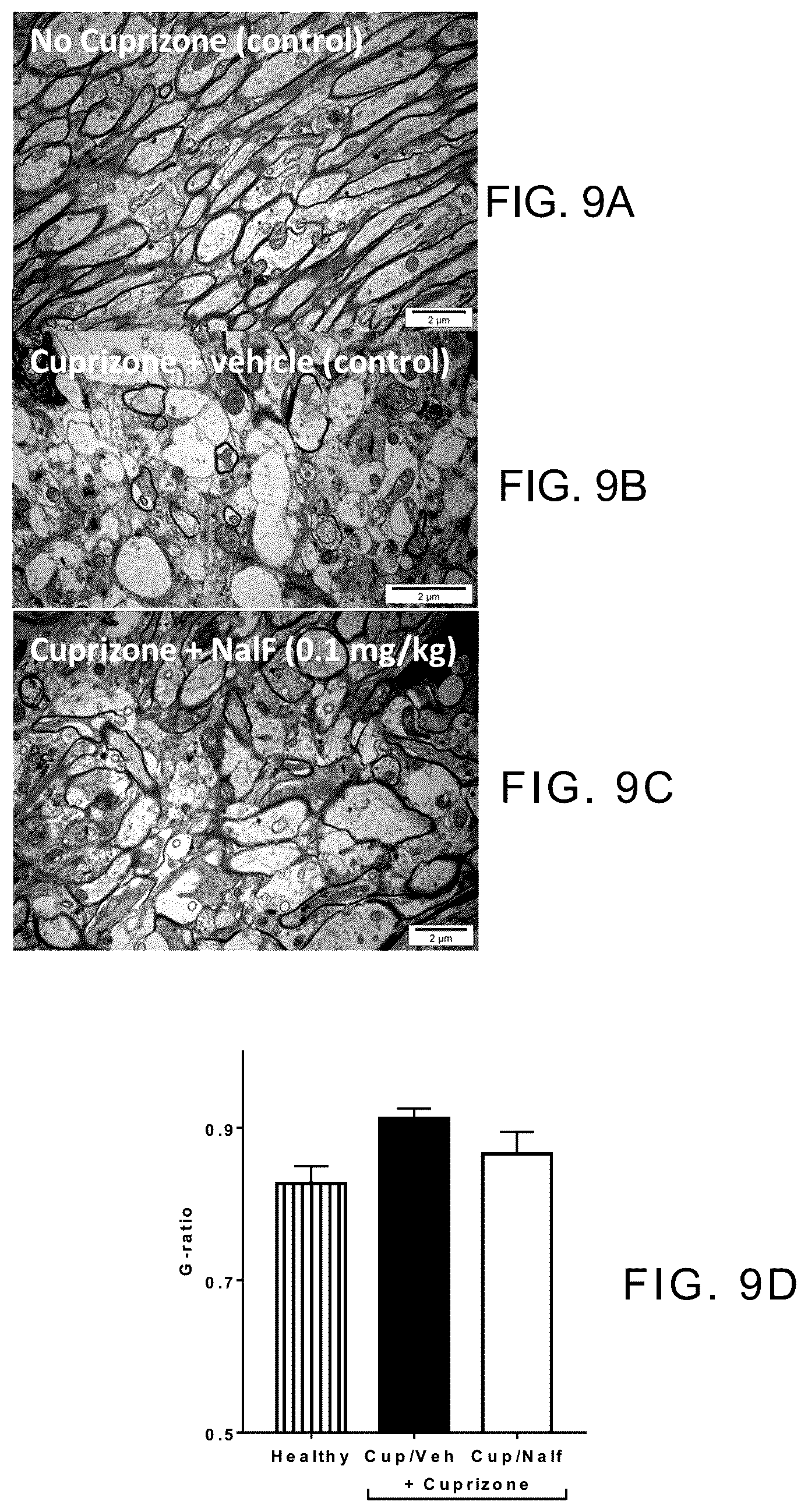 Patent US12318380 Figure 7 – Treatment of demyelinating diseases