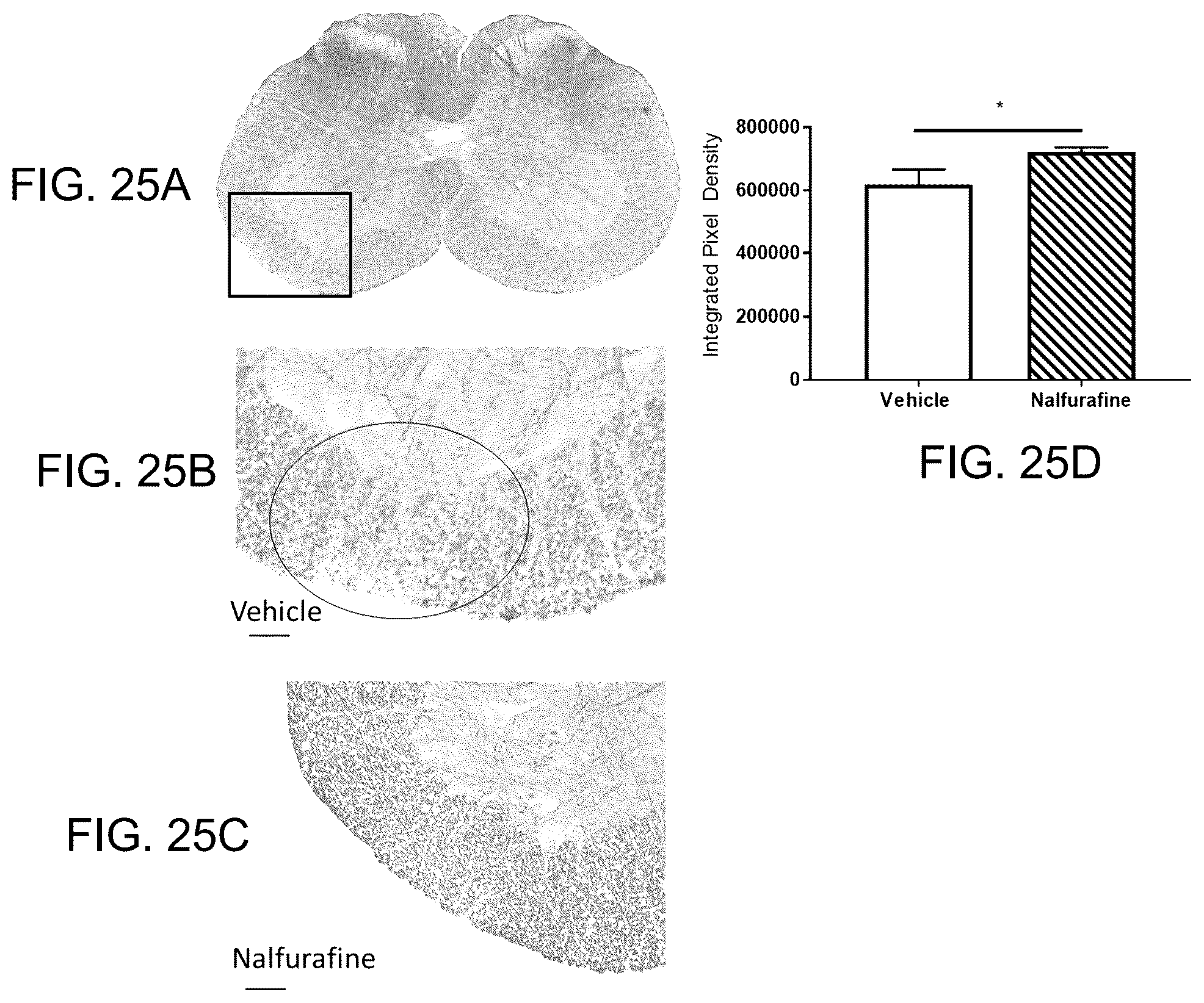 Patent US12318380 Figure 17 – Treatment of demyelinating diseases