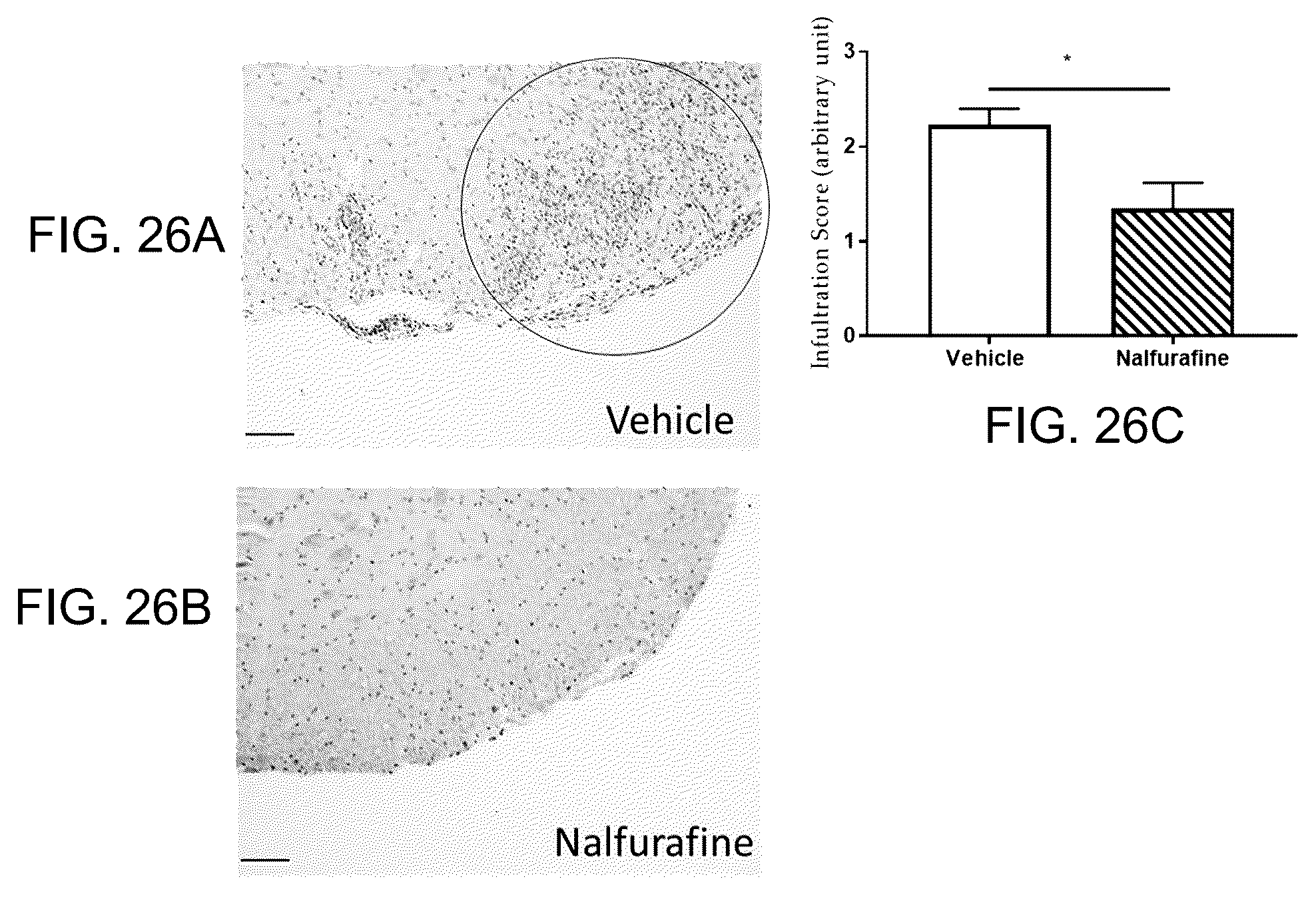 Patent US12318380 Figure 18 – Treatment of demyelinating diseases