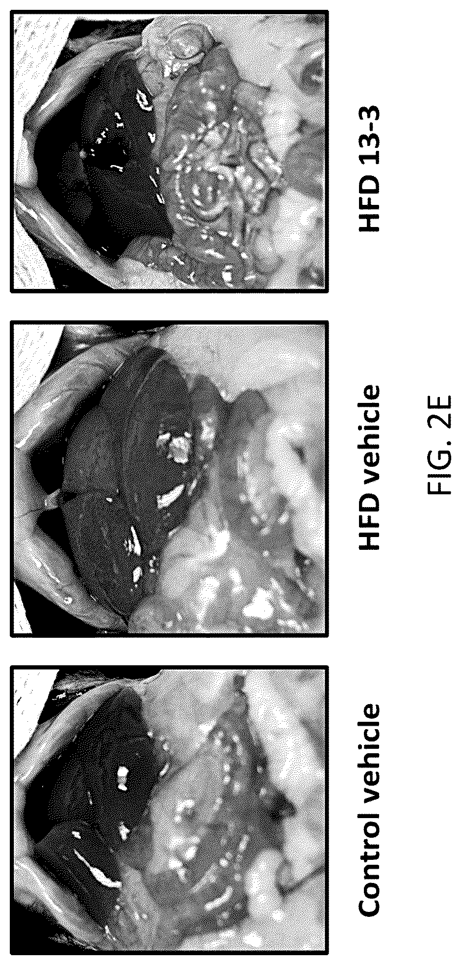 Patent US12318381 Figure 5 – Treatment for non-alcoholic fatty liver disease